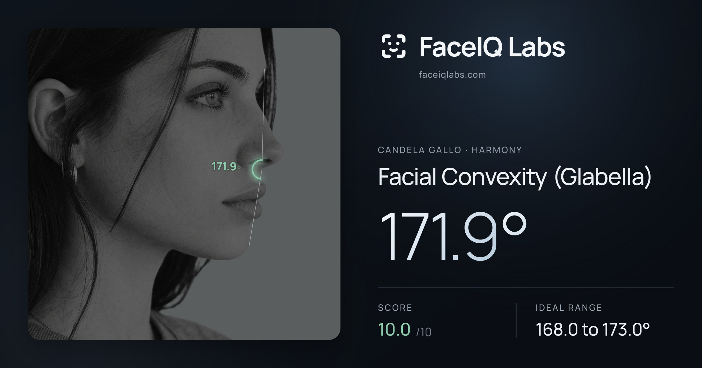 Candela Gallo Facial Convexity (Glabella): 171.9°, drawn on the photo