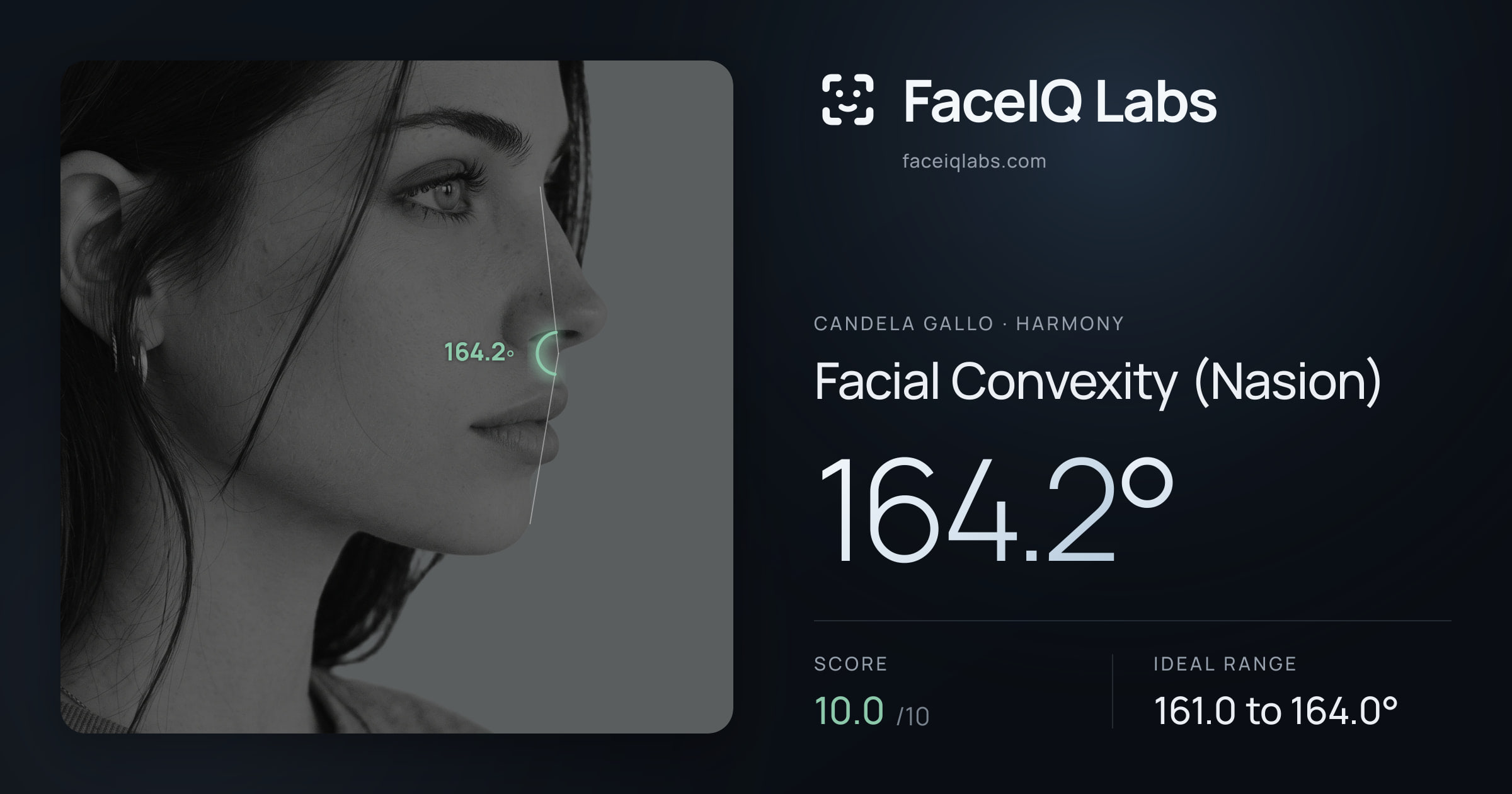 Candela Gallo Facial Convexity (Nasion): 169.4°, drawn on the photo