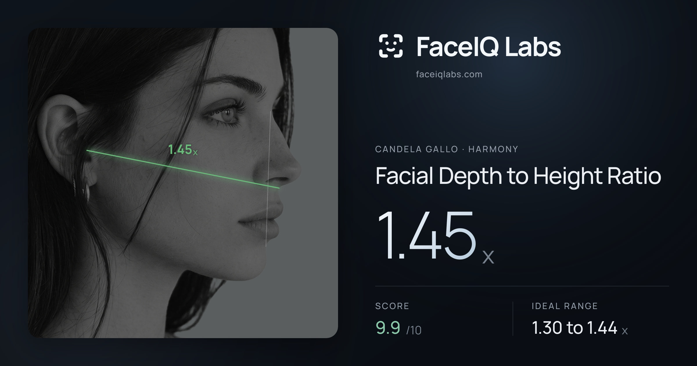 Candela Gallo Facial Depth to Height Ratio: 1.45x, drawn on the photo