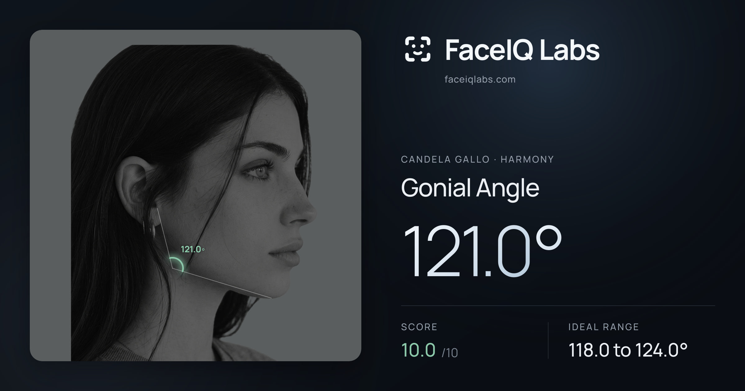 Candela Gallo Gonial Angle: 121.0°, drawn on the photo
