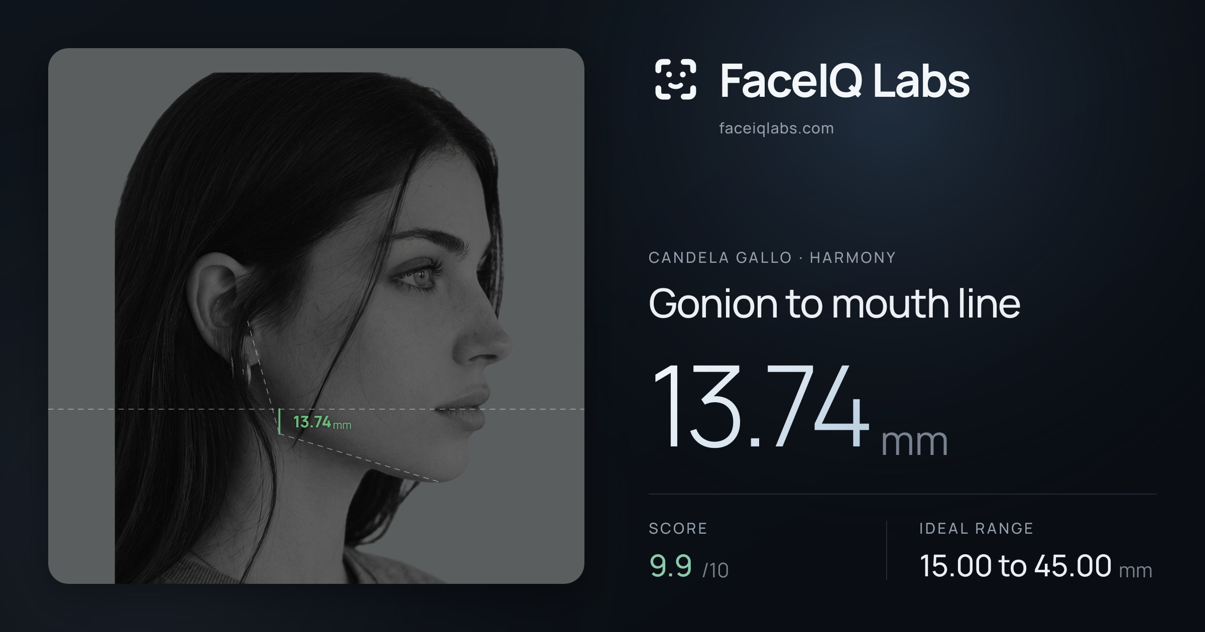 Candela Gallo Gonion to mouth line: 13.74mm, drawn on the photo