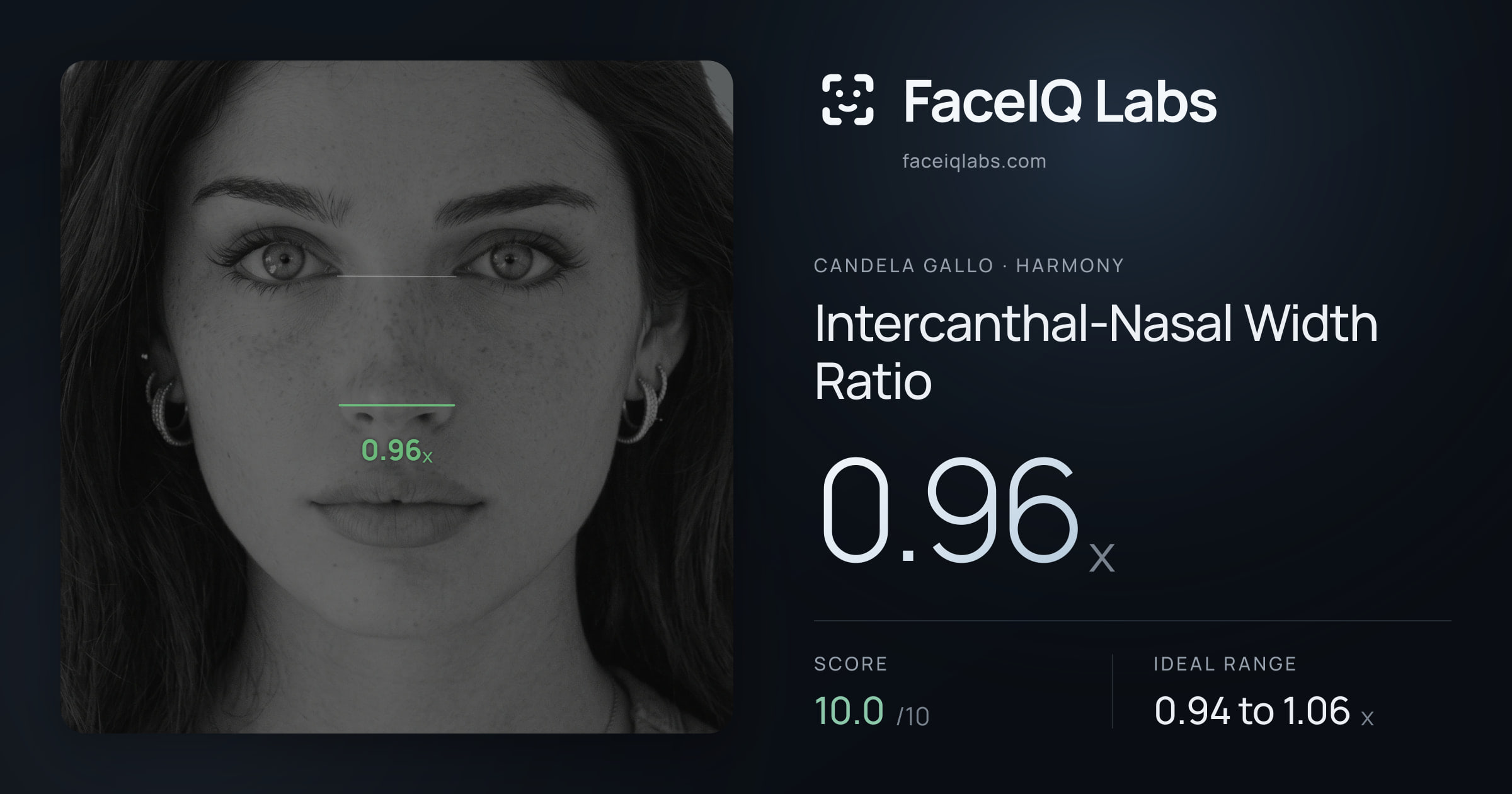 Candela Gallo Intercanthal-Nasal Width Ratio: 0.96x, drawn on the photo