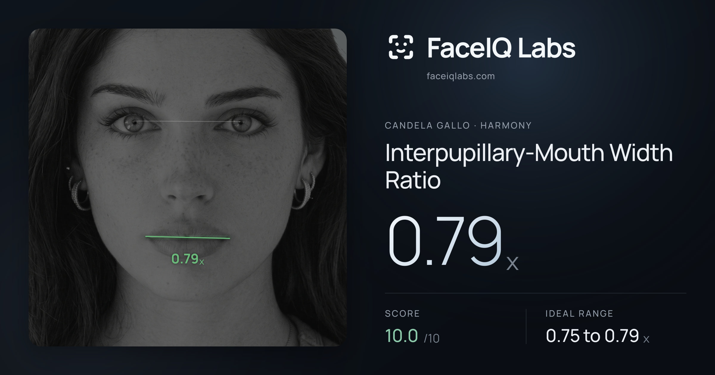 Candela Gallo Interpupillary-Mouth Width Ratio: 0.79x, drawn on the photo