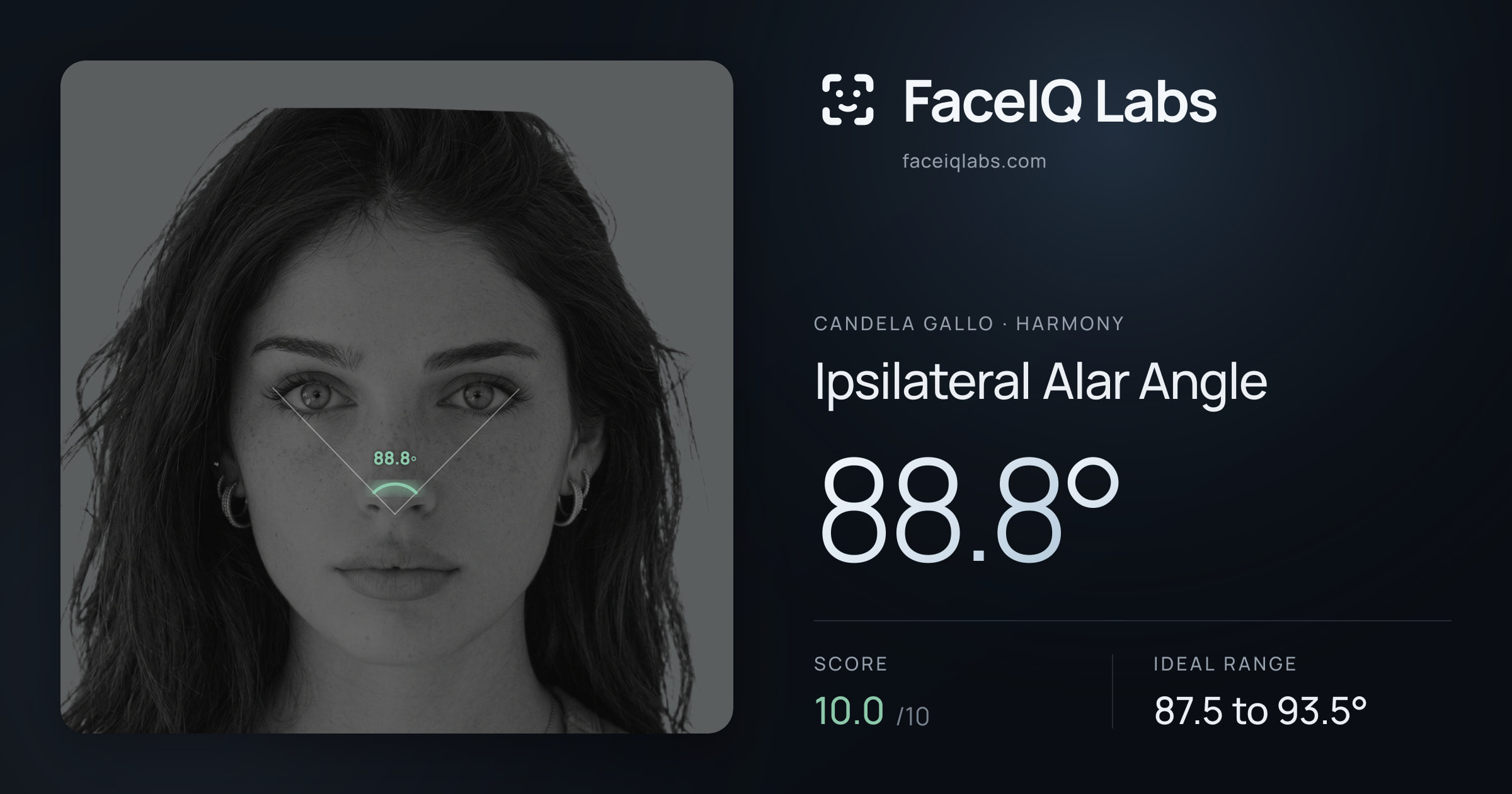 Candela Gallo Ipsilateral Alar Angle: 88.8°, drawn on the photo