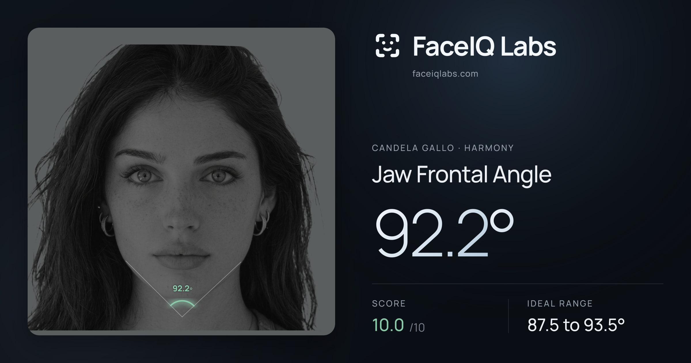 Candela Gallo Jaw Frontal Angle: 92.2°, drawn on the photo