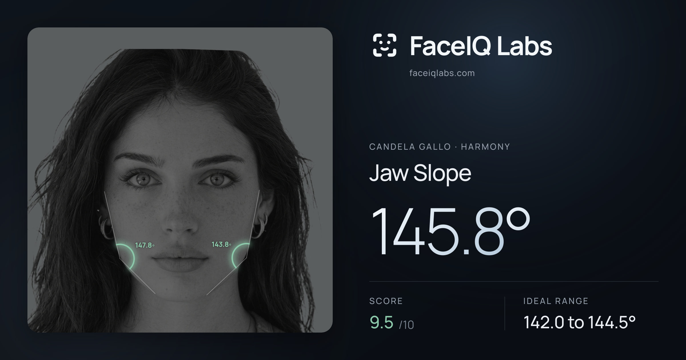 Candela Gallo Jaw Slope: 145.8°, drawn on the photo