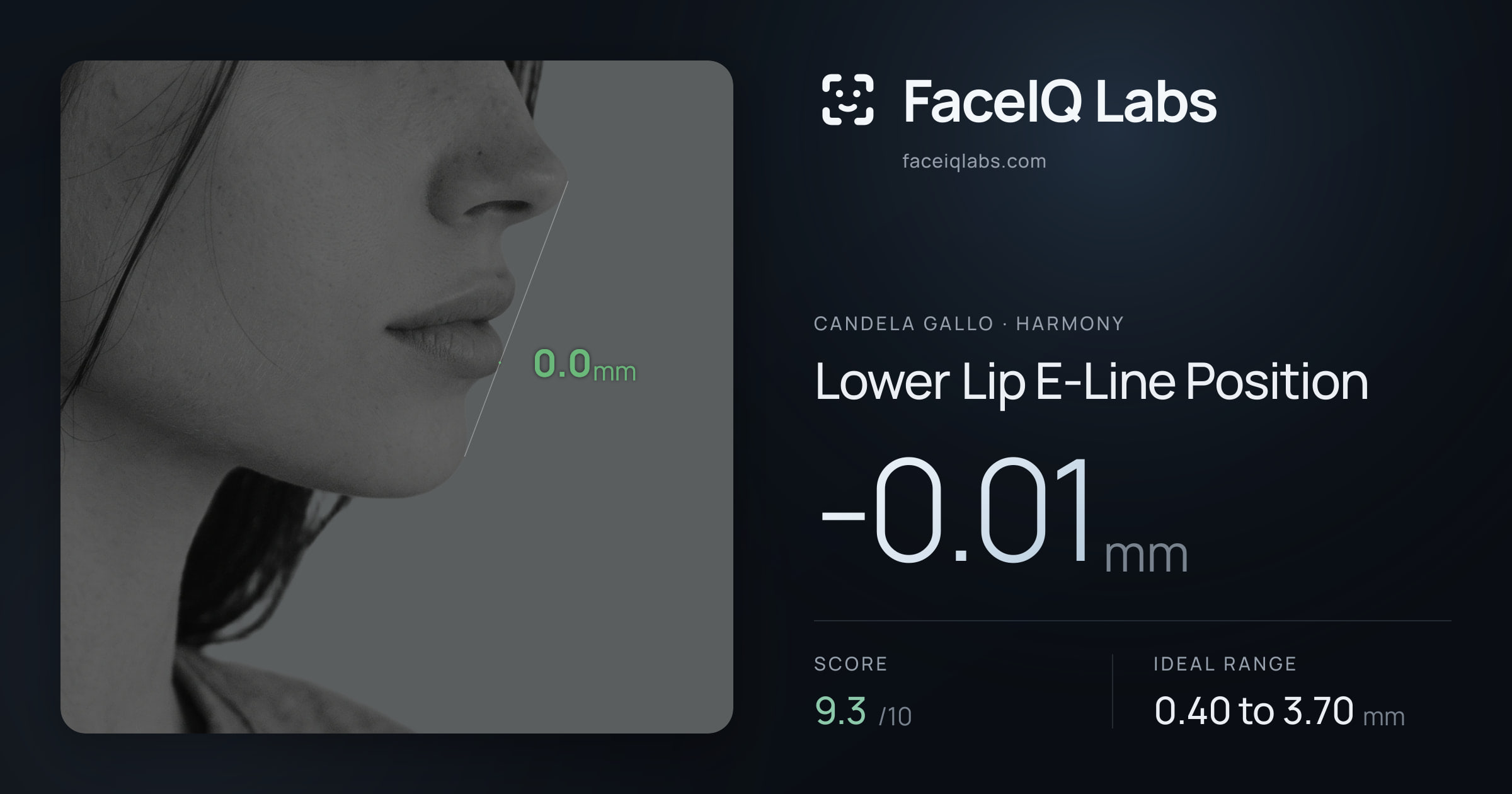 Candela Gallo Lower Lip E-Line Position: -0.01mm, drawn on the photo