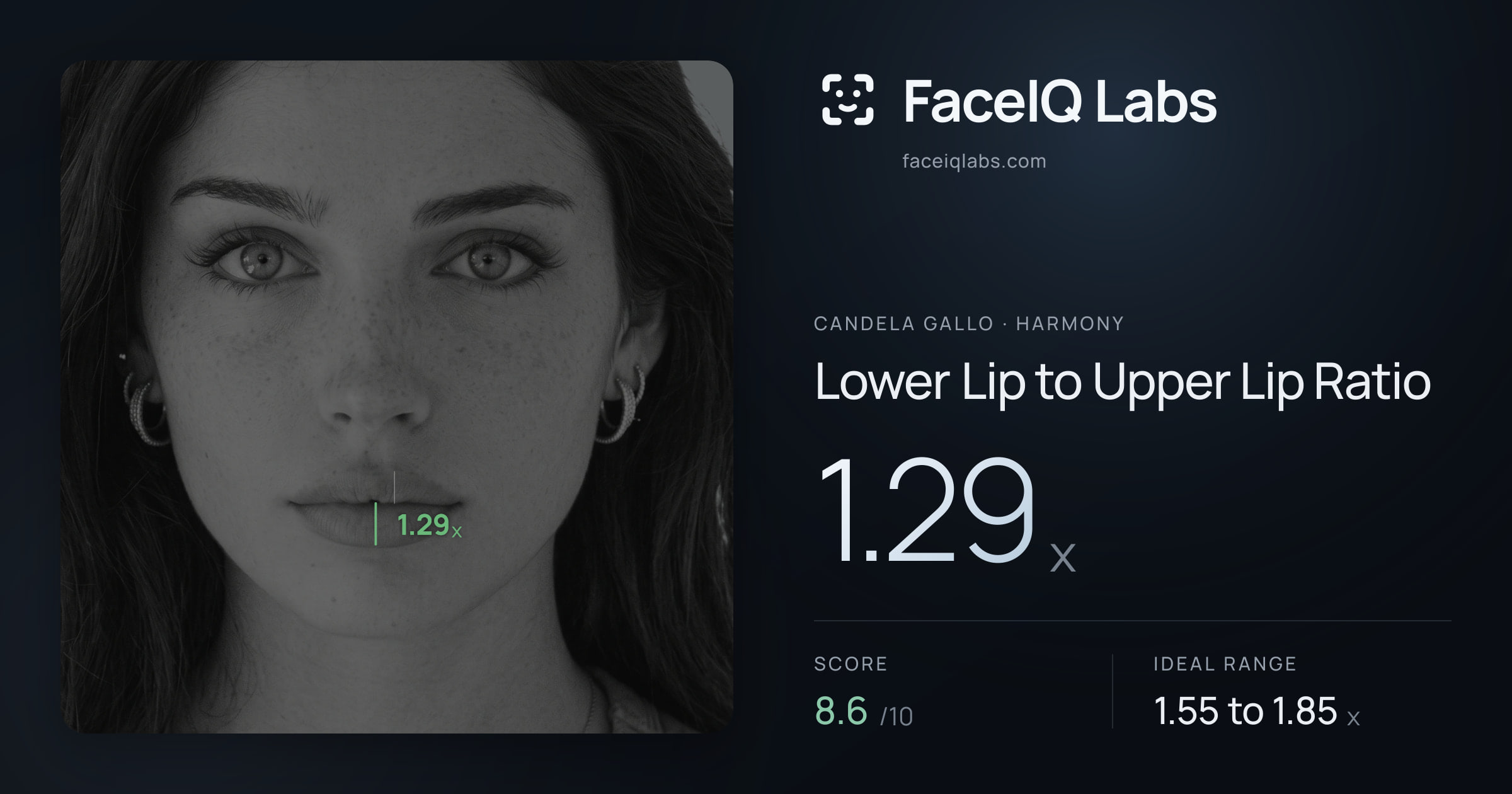 Candela Gallo Lower Lip to Upper Lip Ratio: 1.29x, drawn on the photo