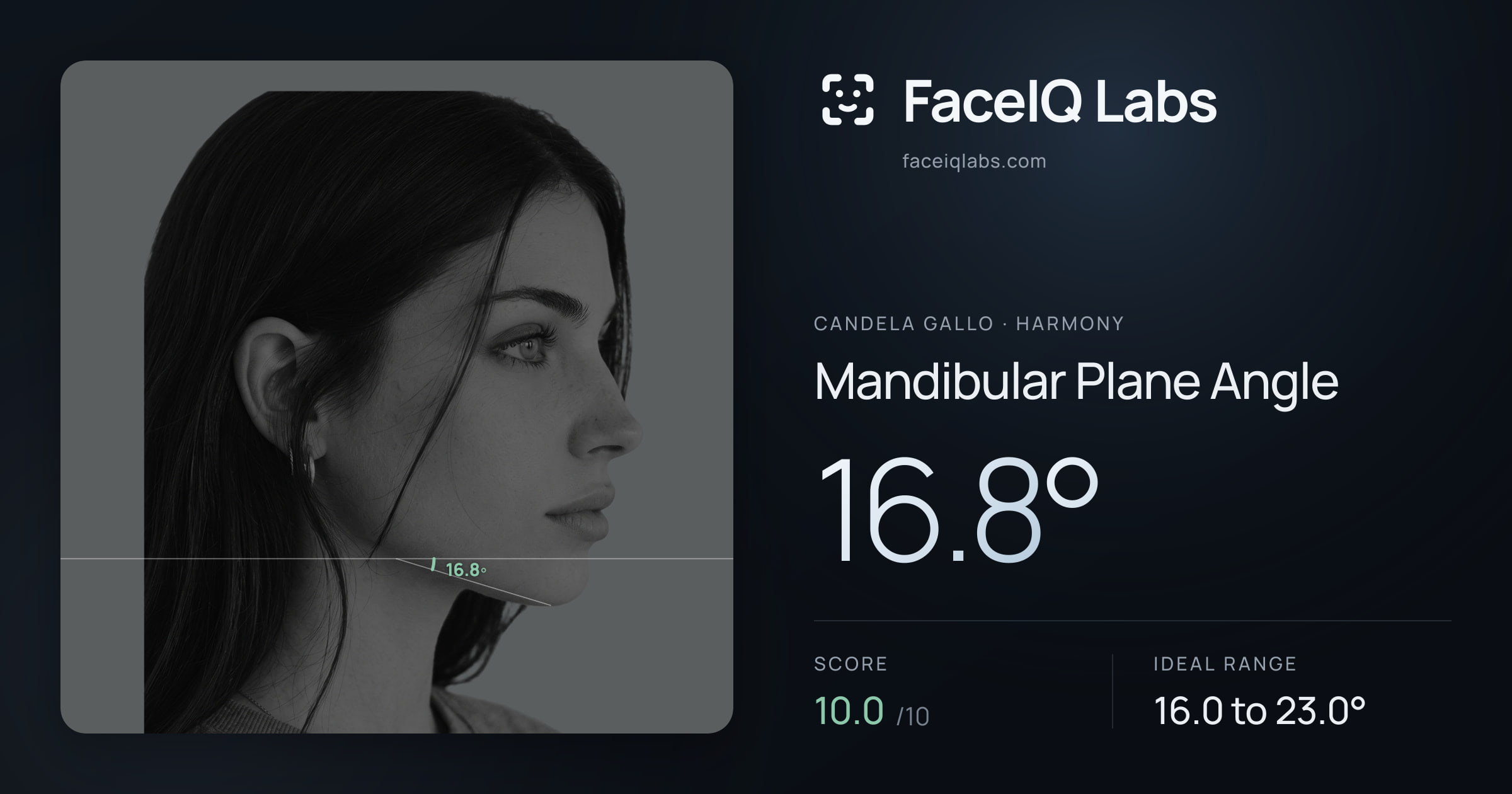 Candela Gallo Mandibular Plane Angle: 16.8°, drawn on the photo