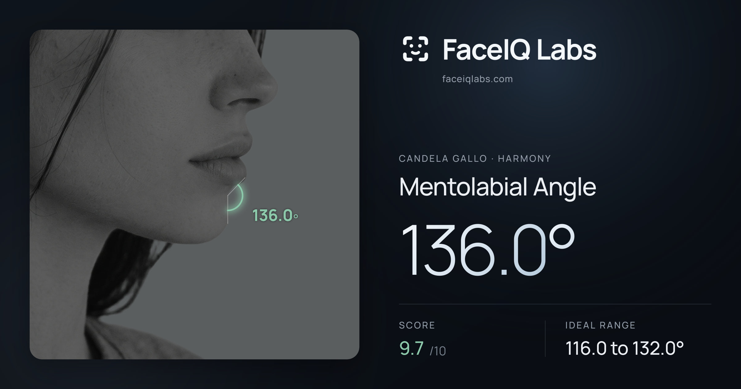 Candela Gallo Mentolabial Angle: 136.0°, drawn on the photo