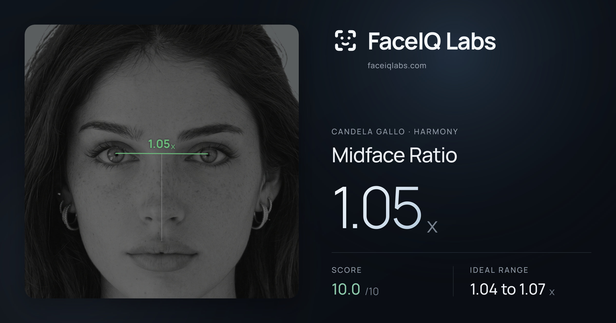 Candela Gallo Midface Ratio: 1.05x, drawn on the photo