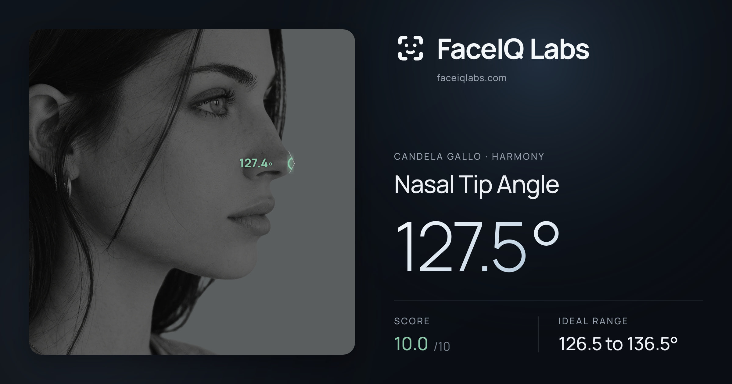 Candela Gallo Nasal Tip Angle: 127.5°, drawn on the photo