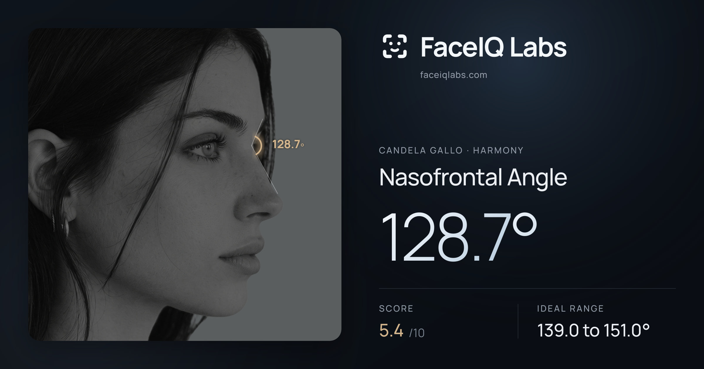 Candela Gallo Nasofrontal Angle: 128.7°, drawn on the photo