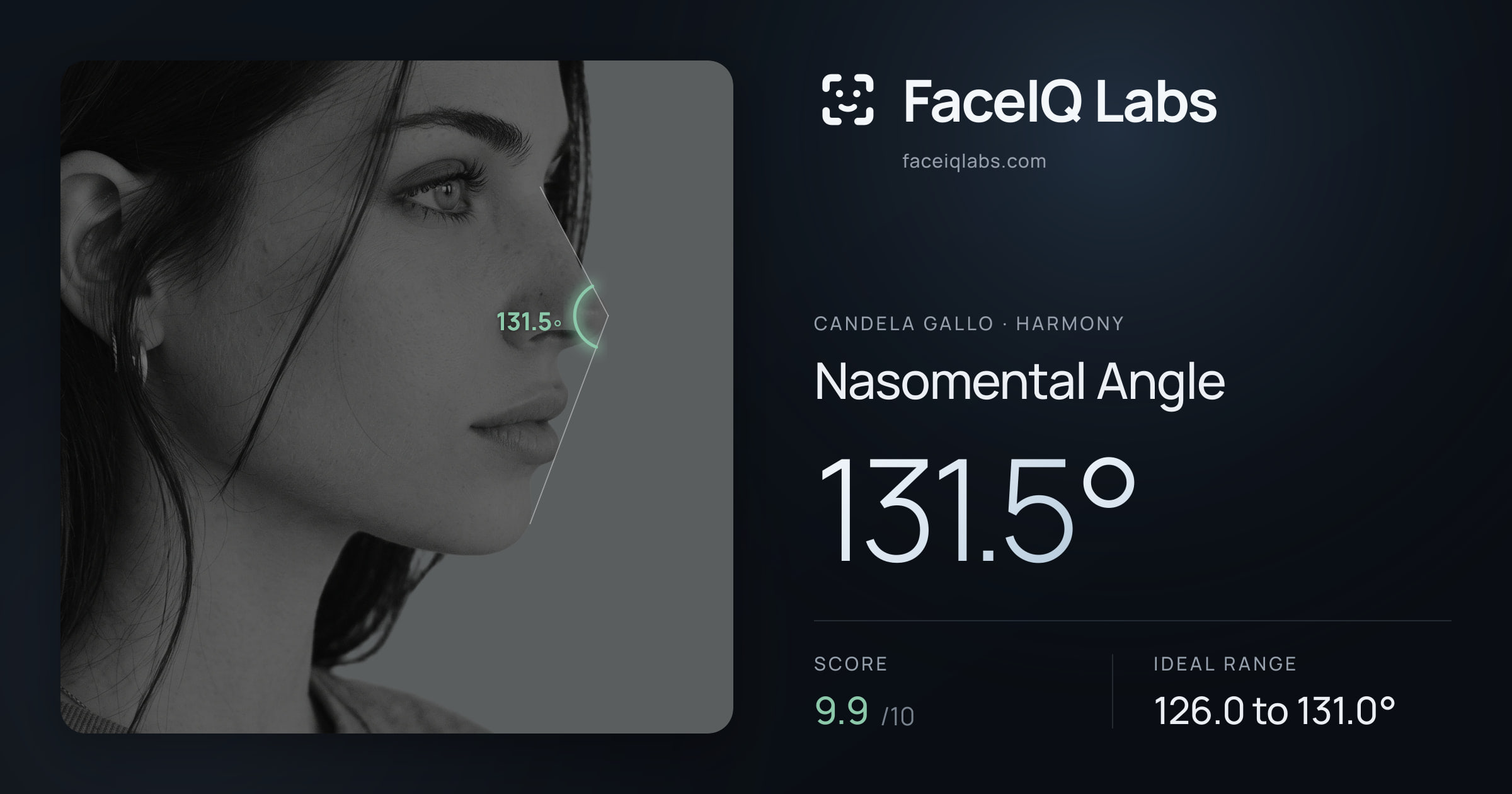 Candela Gallo Nasomental Angle: 131.5°, drawn on the photo