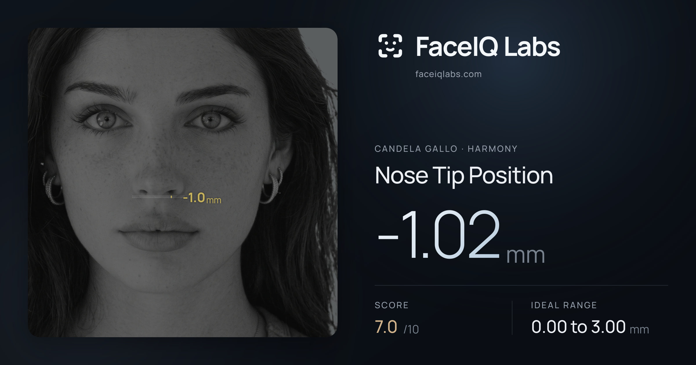 Candela Gallo Nose Tip Position: -1.02mm, drawn on the photo