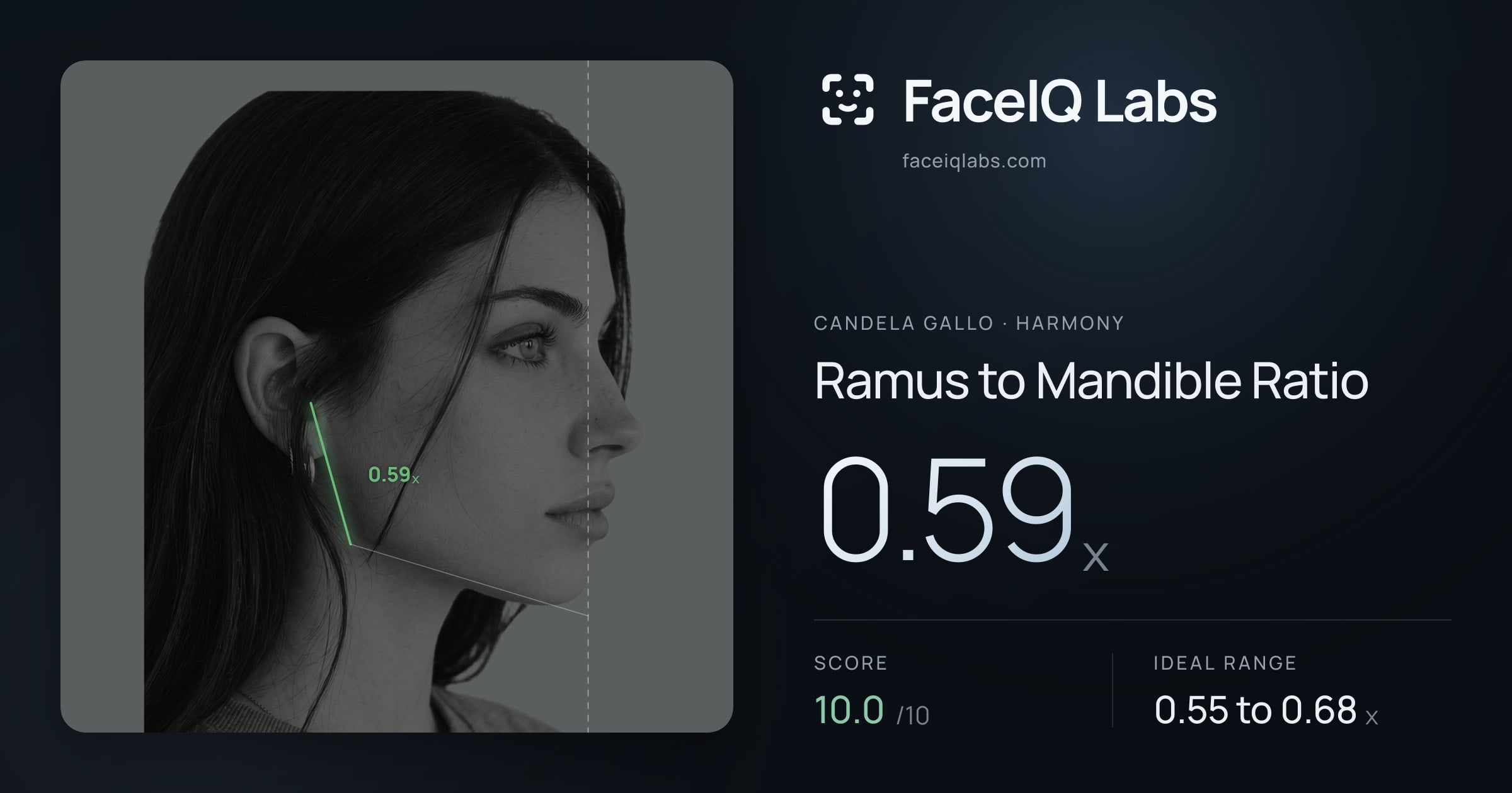 Candela Gallo Ramus to Mandible Ratio: 0.59x, drawn on the photo