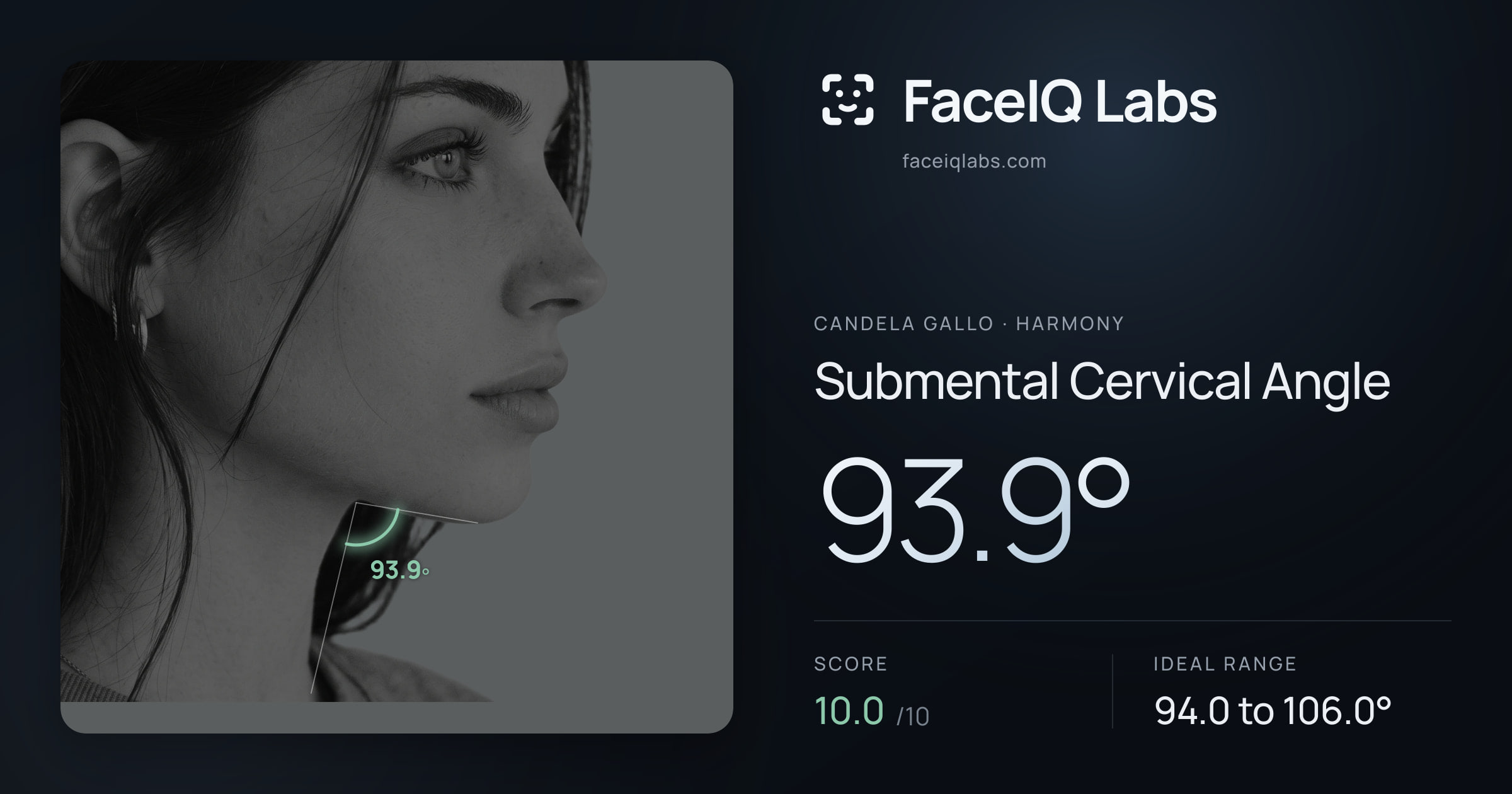 Candela Gallo Submental Cervical Angle: 93.9°, drawn on the photo