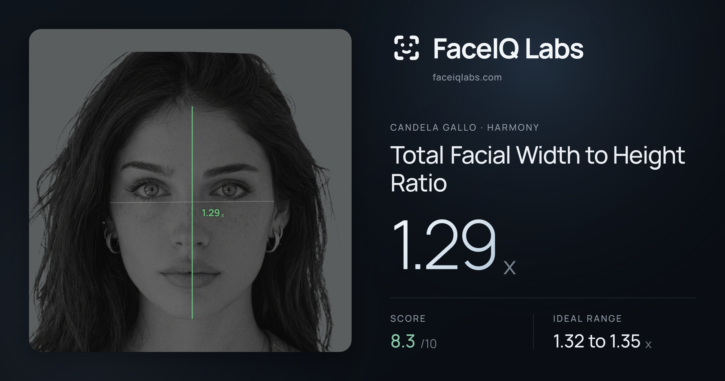 Candela Gallo Total Facial Width to Height Ratio: 1.54x, drawn on the photo