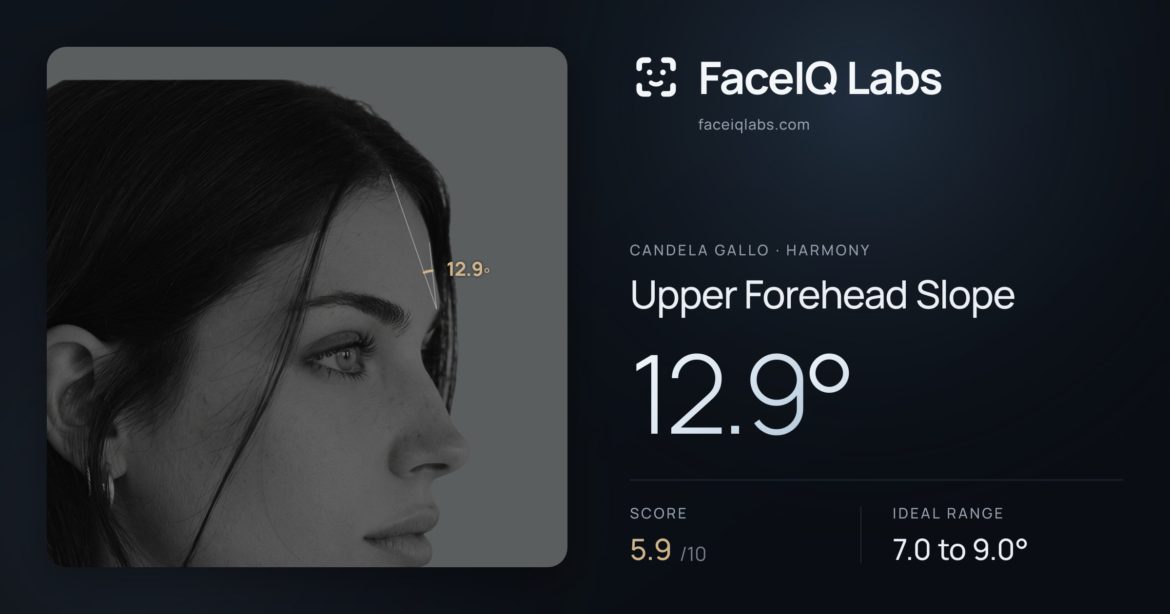Candela Gallo Upper Forehead Slope: 12.9°, drawn on the photo