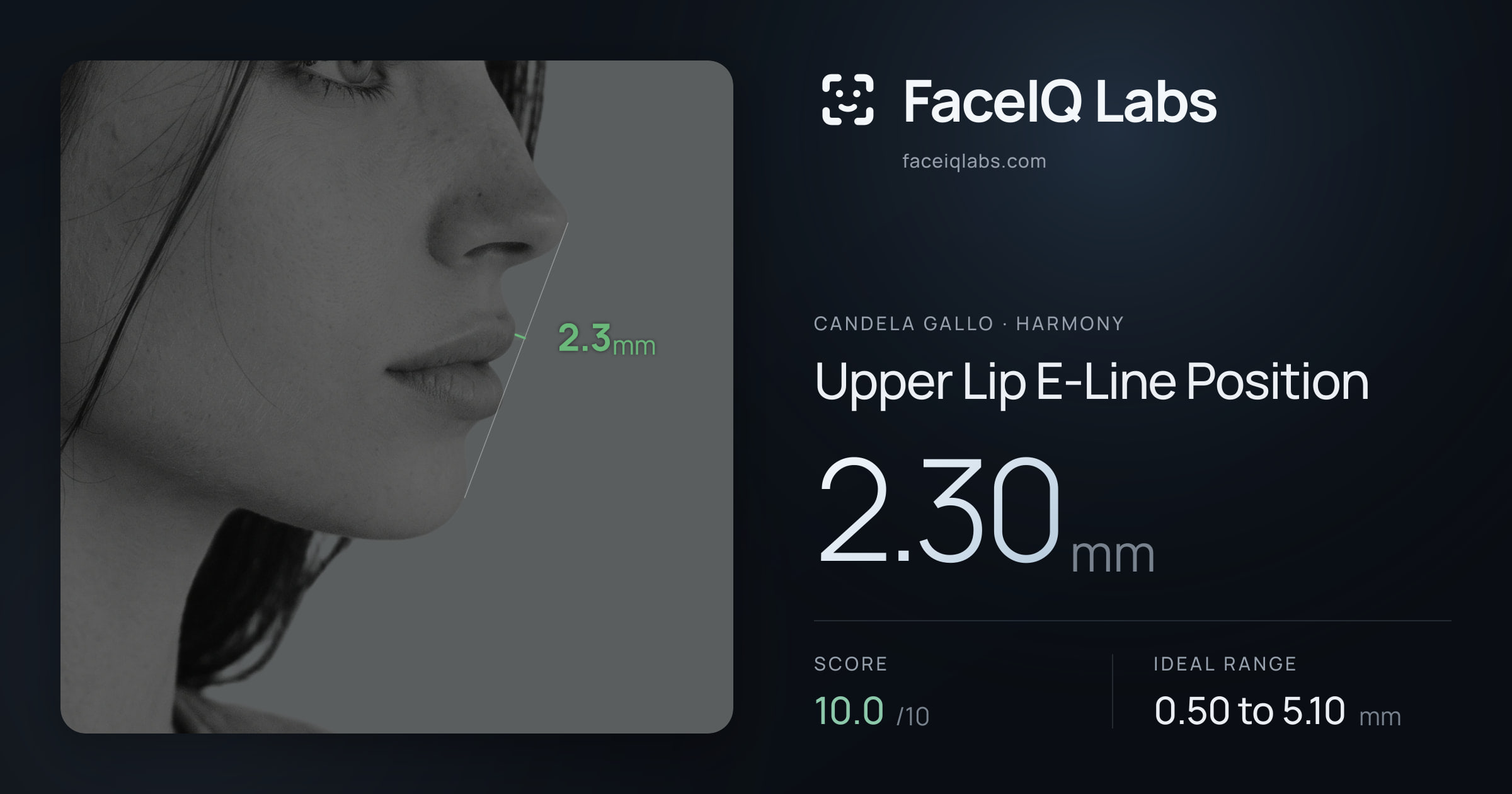 Candela Gallo Upper Lip E-Line Position: 2.30mm, drawn on the photo