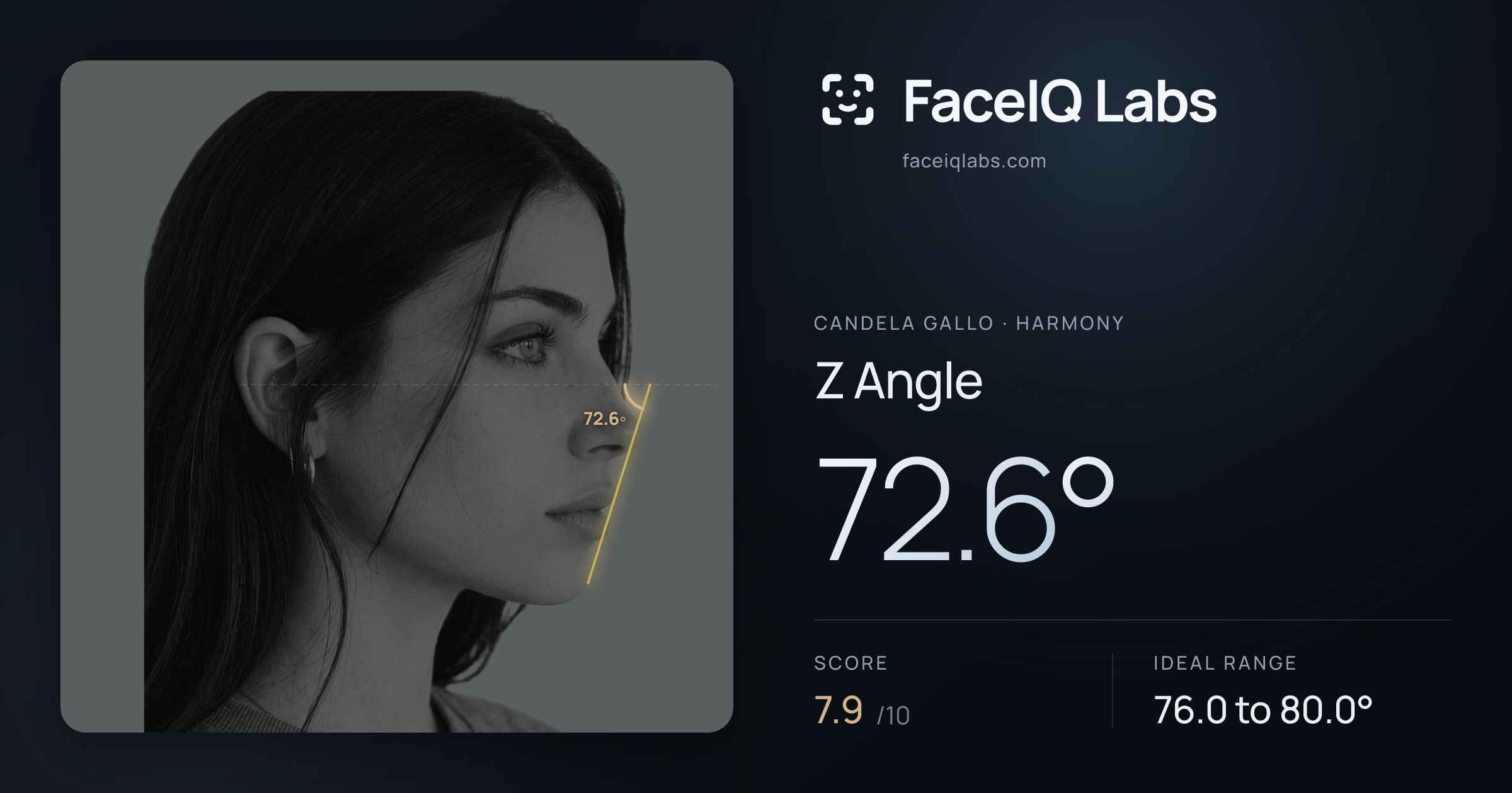 Candela Gallo Z Angle: 72.6°, drawn on the photo