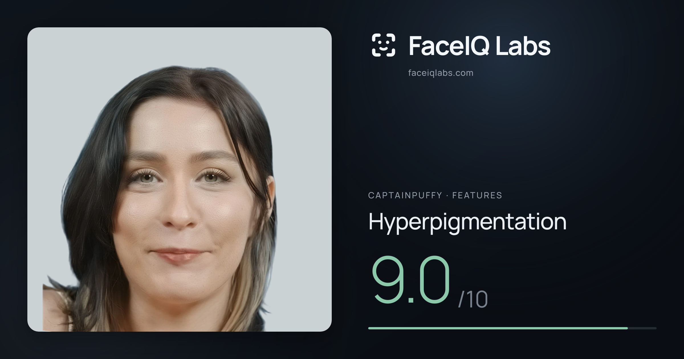 CaptainPuffy Hyperpigmentation: 9.0/10, drawn on the photo