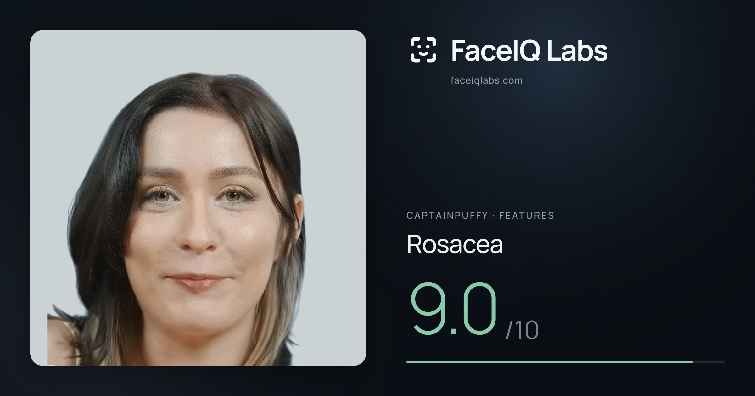 CaptainPuffy Rosacea: 9.0/10, drawn on the photo