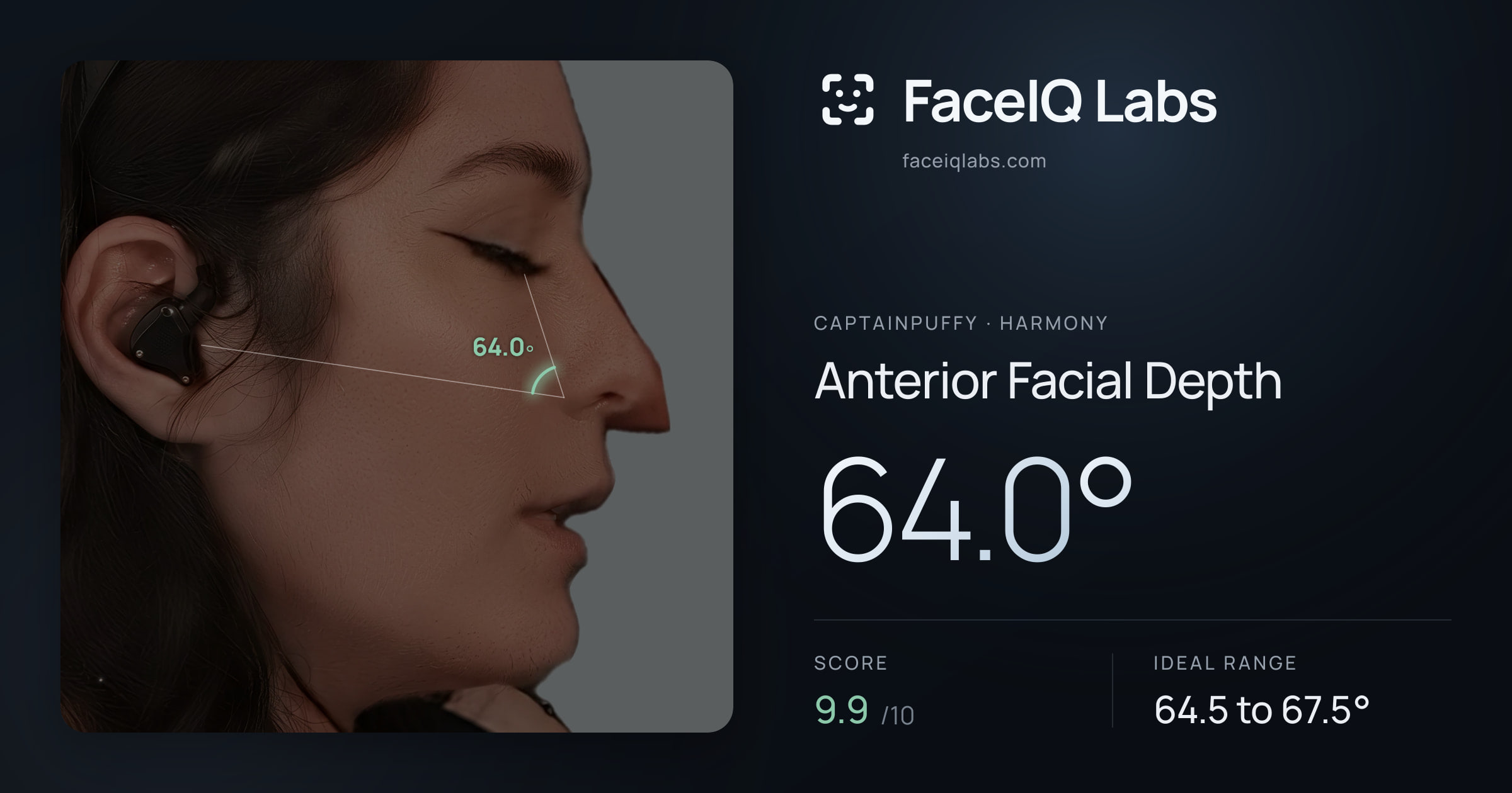 CaptainPuffy Anterior Facial Depth: 64.0°, drawn on the photo