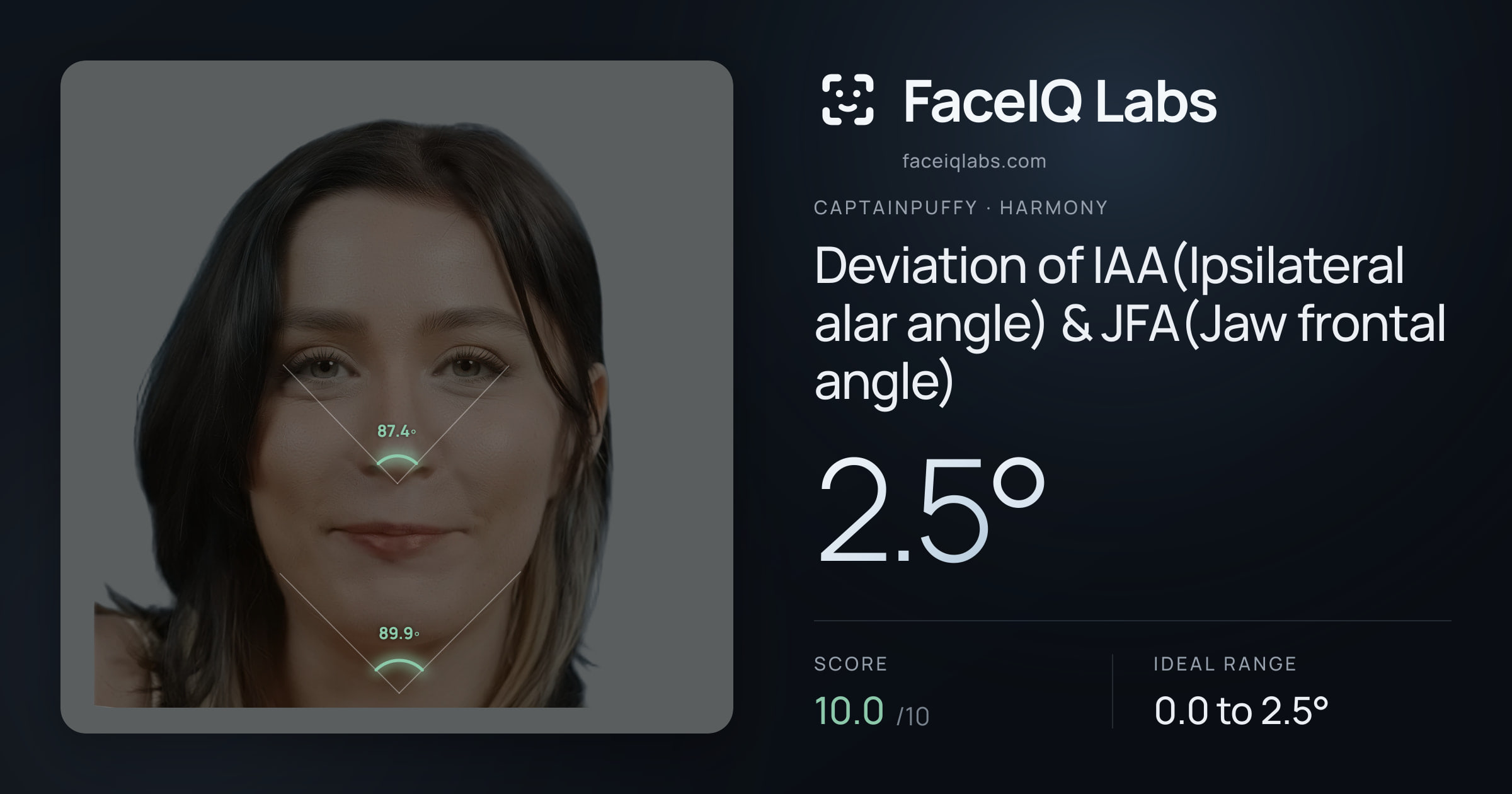 CaptainPuffy Deviation of IAA(Ipsilateral alar angle) & JFA(Jaw frontal angle): 2.5°, drawn on the photo