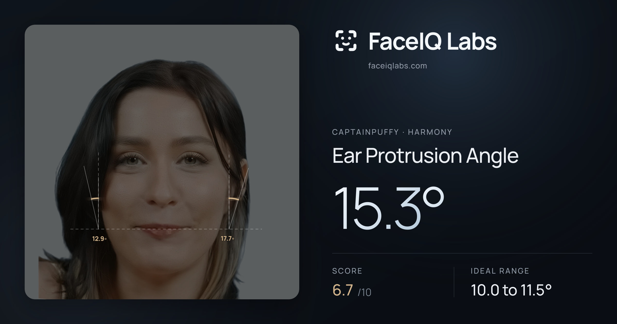 CaptainPuffy Ear Protrusion Angle: 15.3°, drawn on the photo