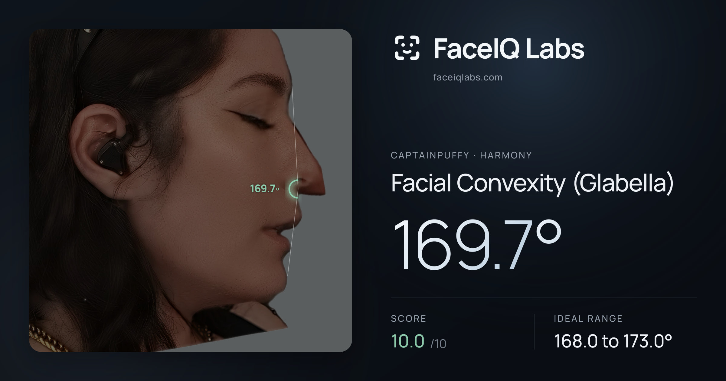 CaptainPuffy Facial Convexity (Glabella): 169.7°, drawn on the photo