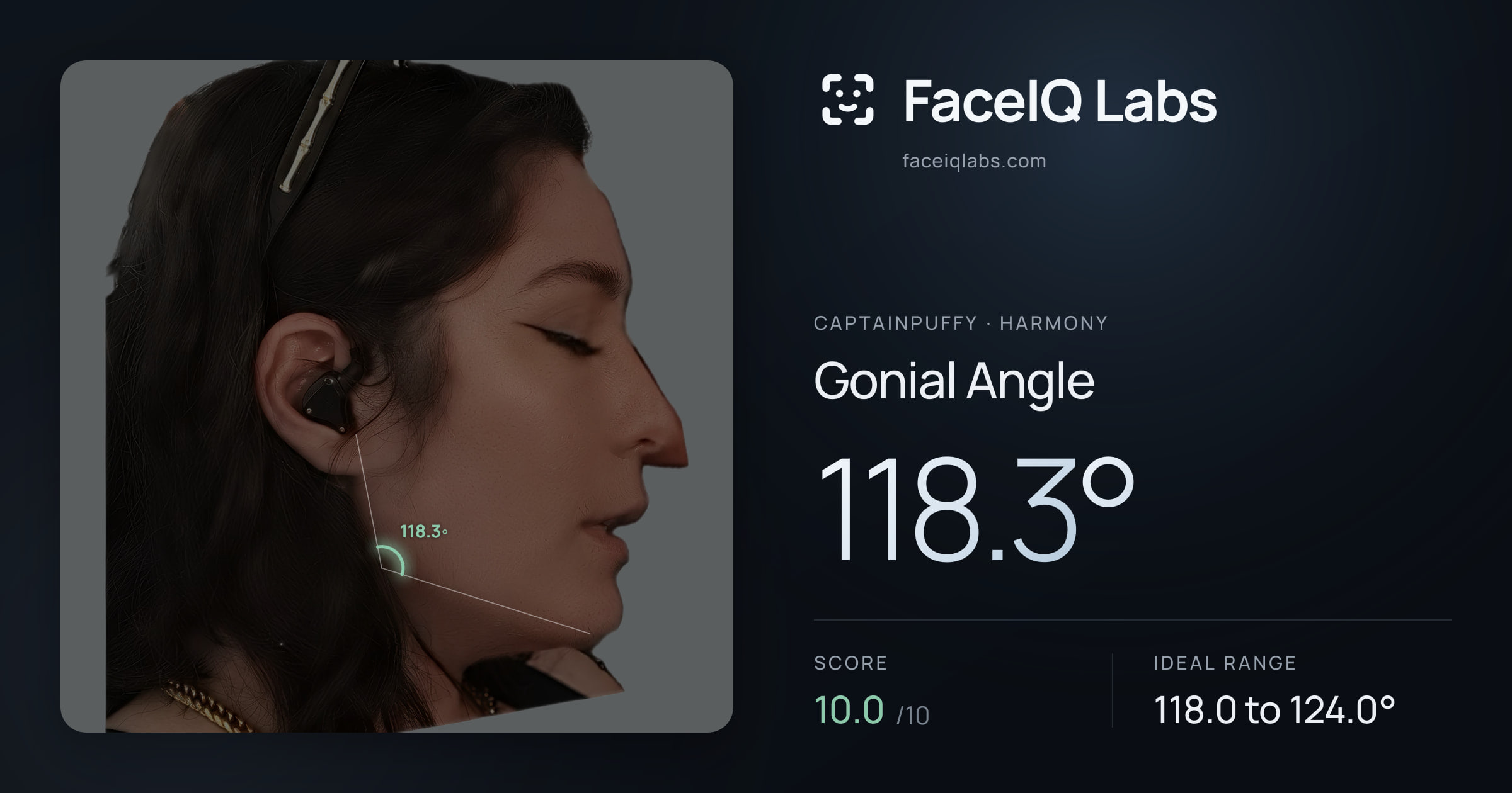 CaptainPuffy Gonial Angle: 118.3°, drawn on the photo