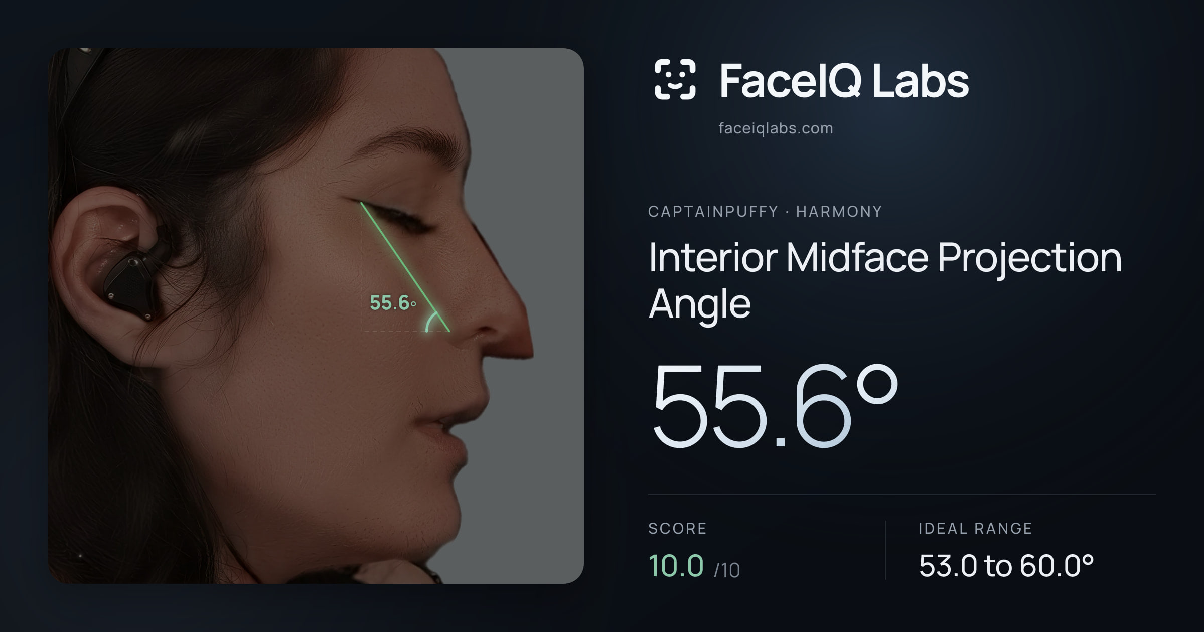 CaptainPuffy Interior Midface Projection Angle: 55.6°, drawn on the photo