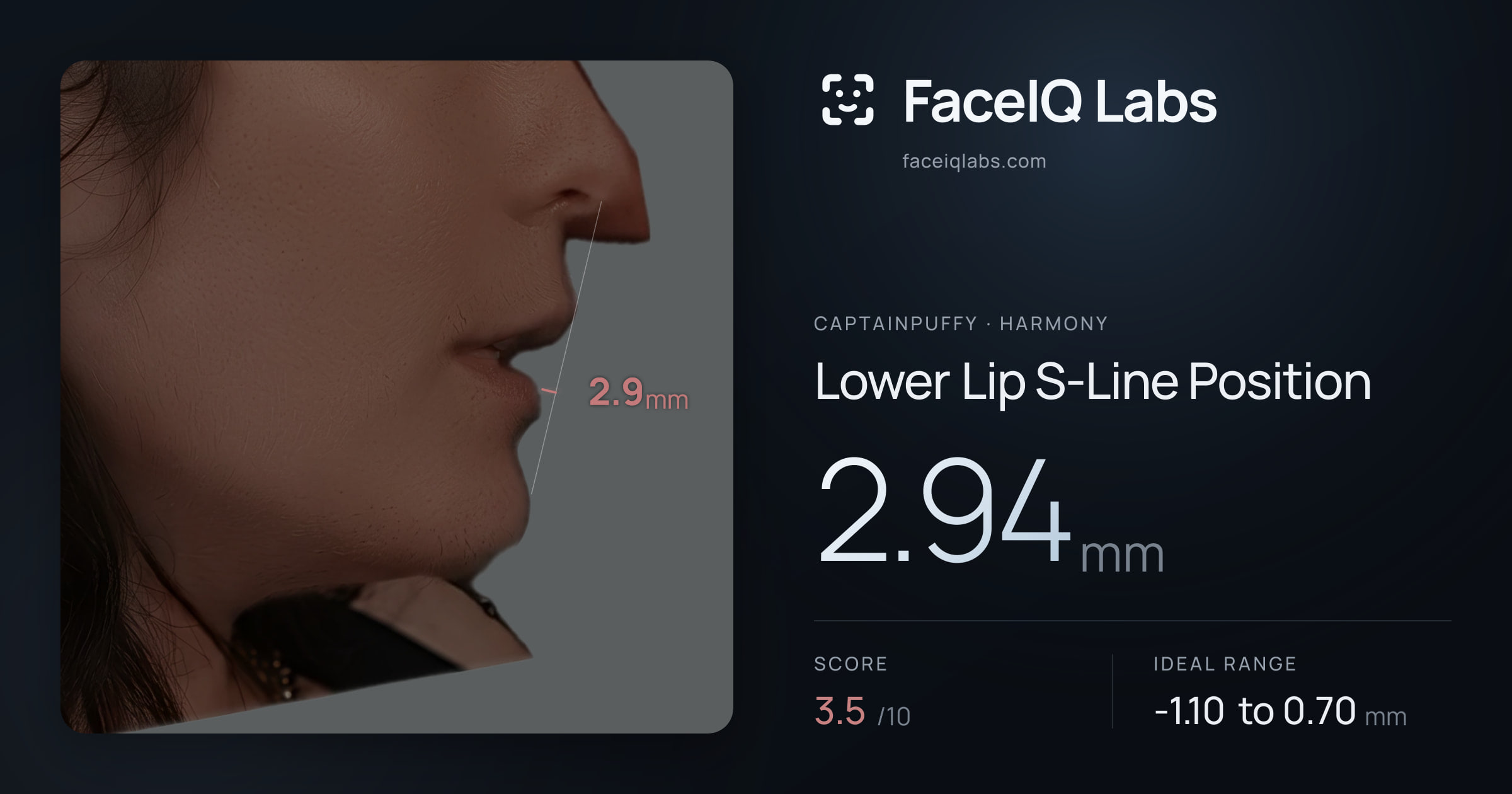 CaptainPuffy Lower Lip S-Line Position: 2.94mm, drawn on the photo