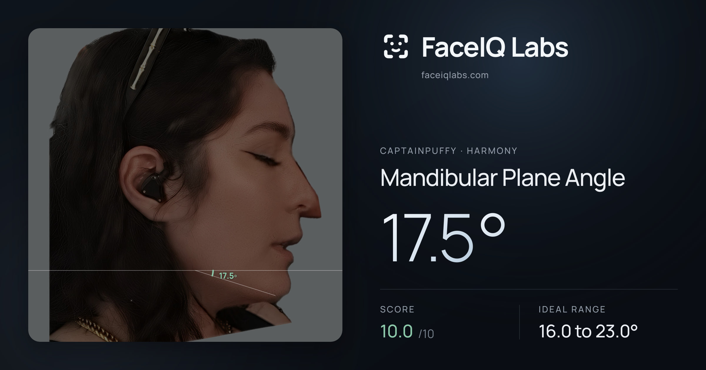 CaptainPuffy Mandibular Plane Angle: 17.5°, drawn on the photo