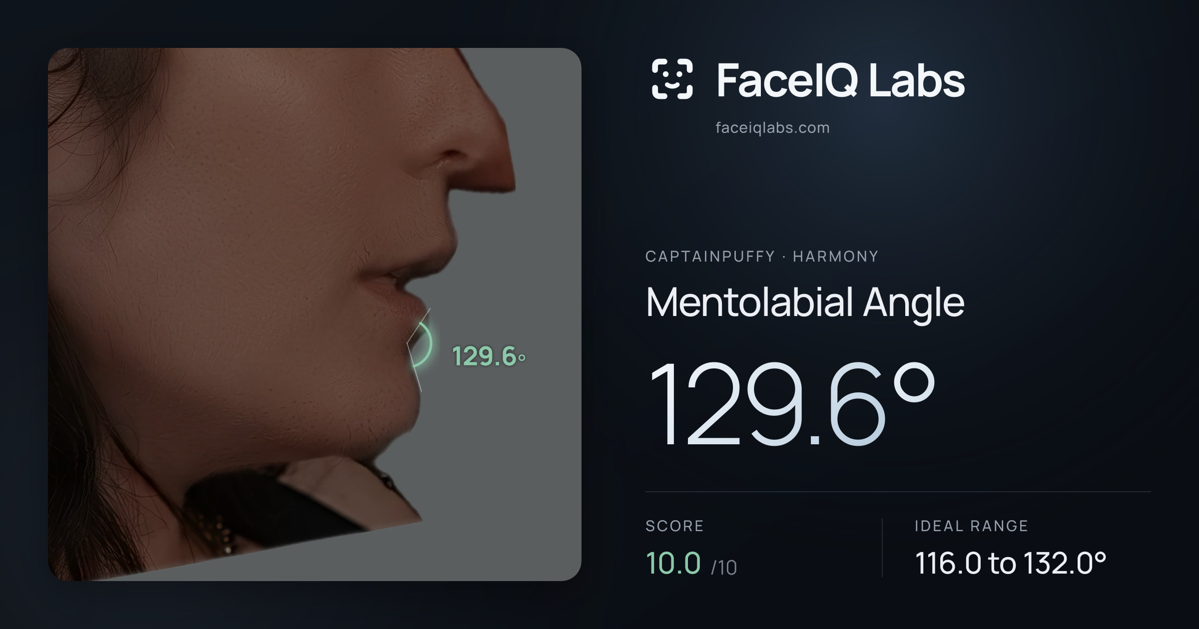 CaptainPuffy Mentolabial Angle: 129.6°, drawn on the photo