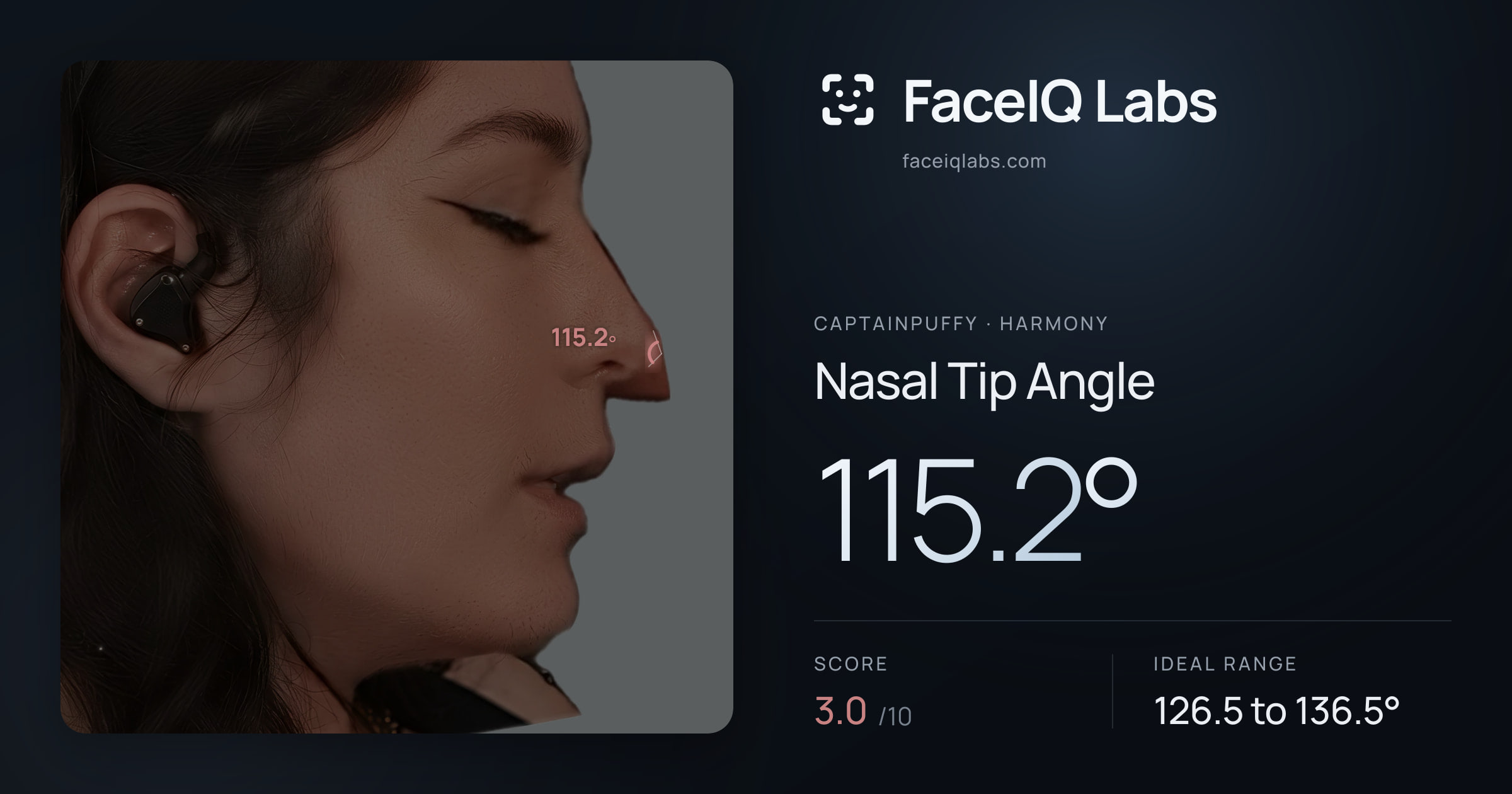 CaptainPuffy Nasal Tip Angle: 115.2°, drawn on the photo