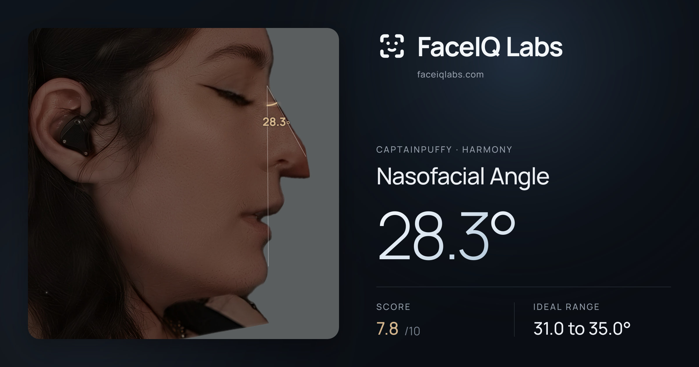 CaptainPuffy Nasofacial Angle: 28.3°, drawn on the photo
