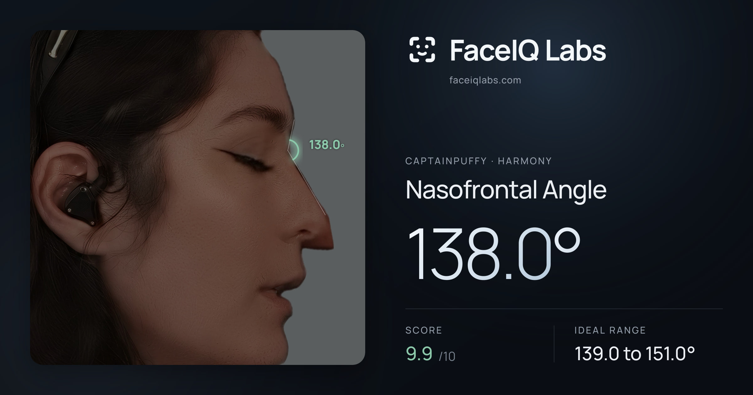 CaptainPuffy Nasofrontal Angle: 138.0°, drawn on the photo