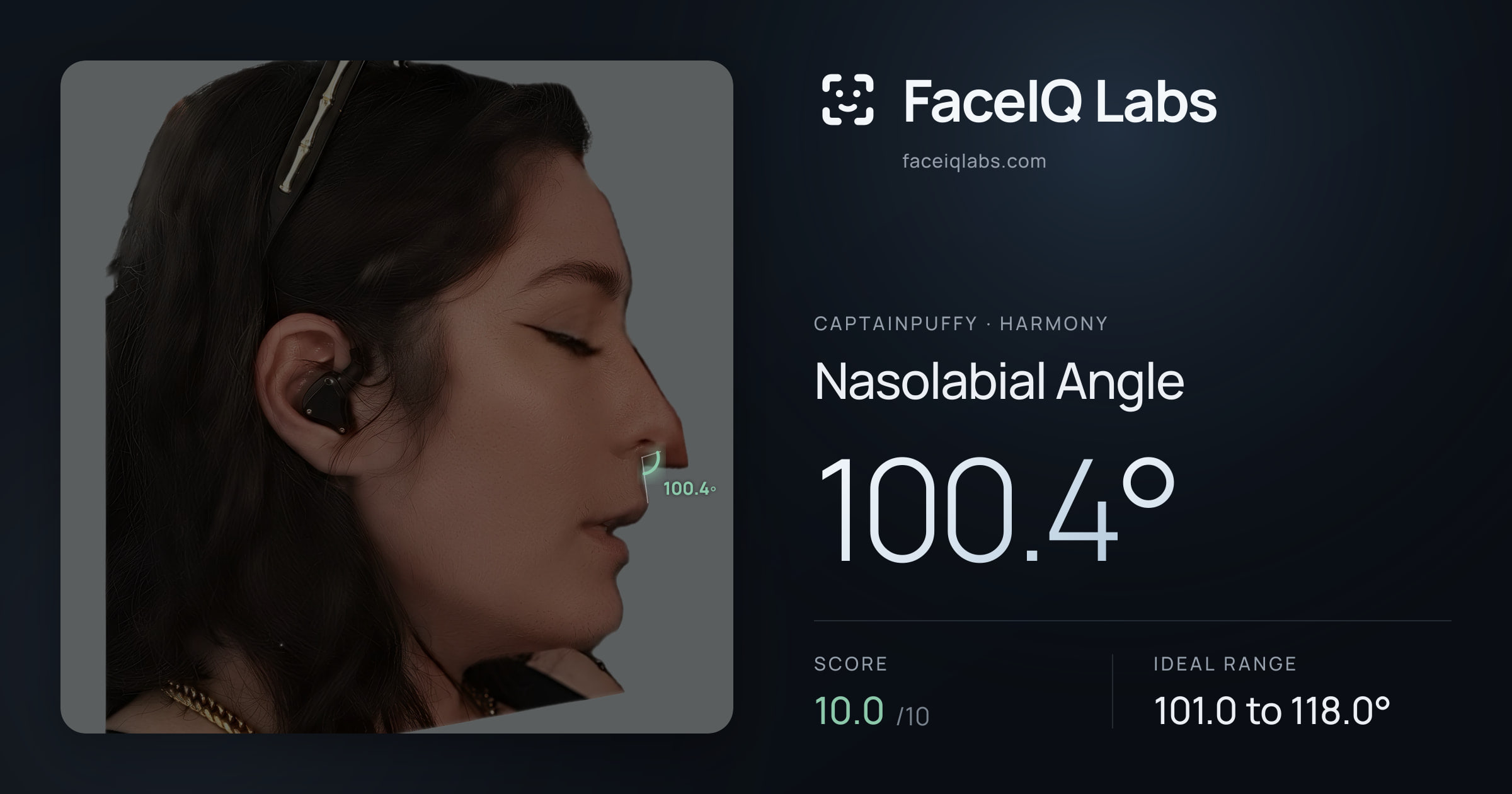 CaptainPuffy Nasolabial Angle: 100.4°, drawn on the photo