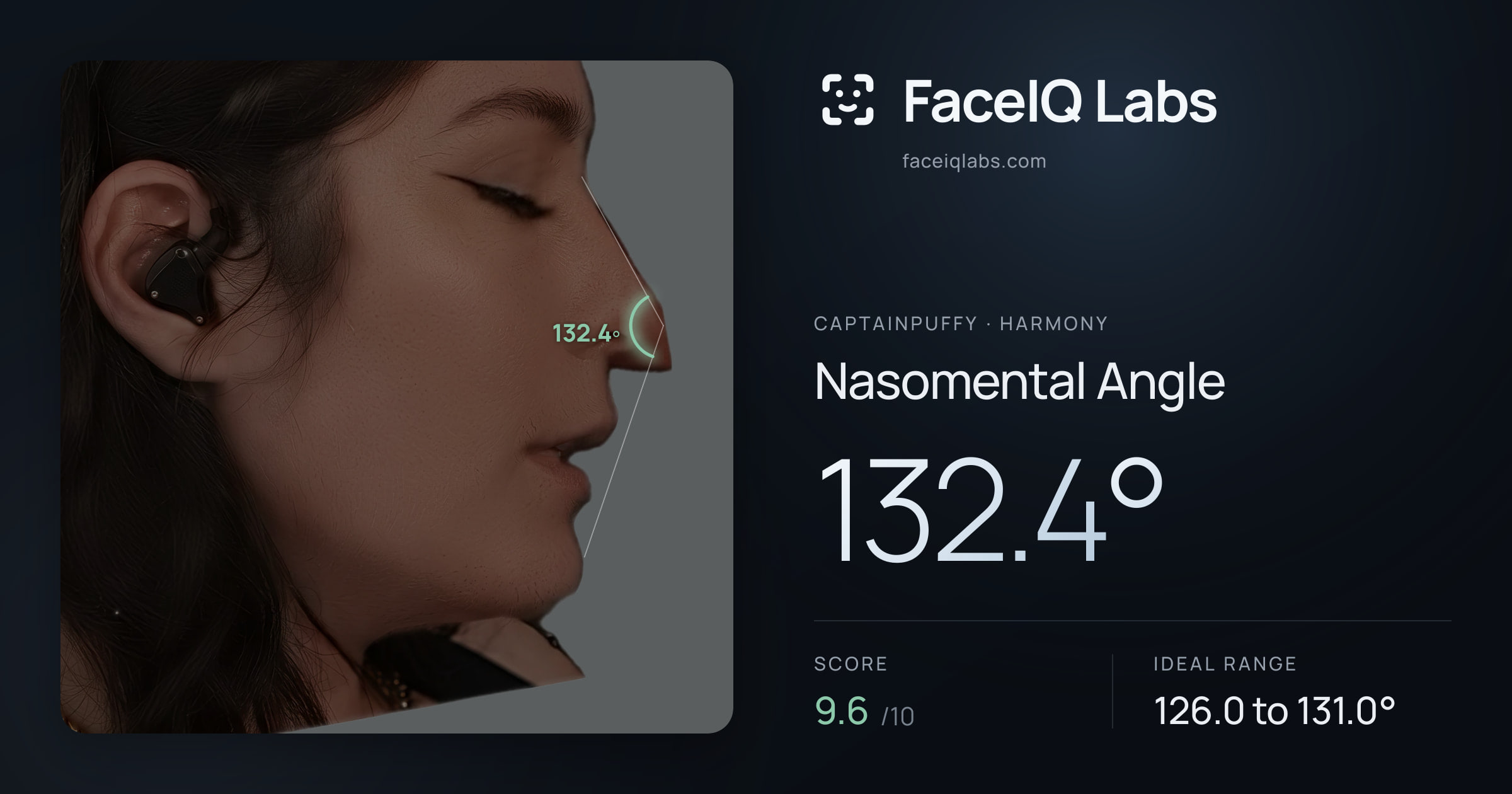 CaptainPuffy Nasomental Angle: 132.4°, drawn on the photo