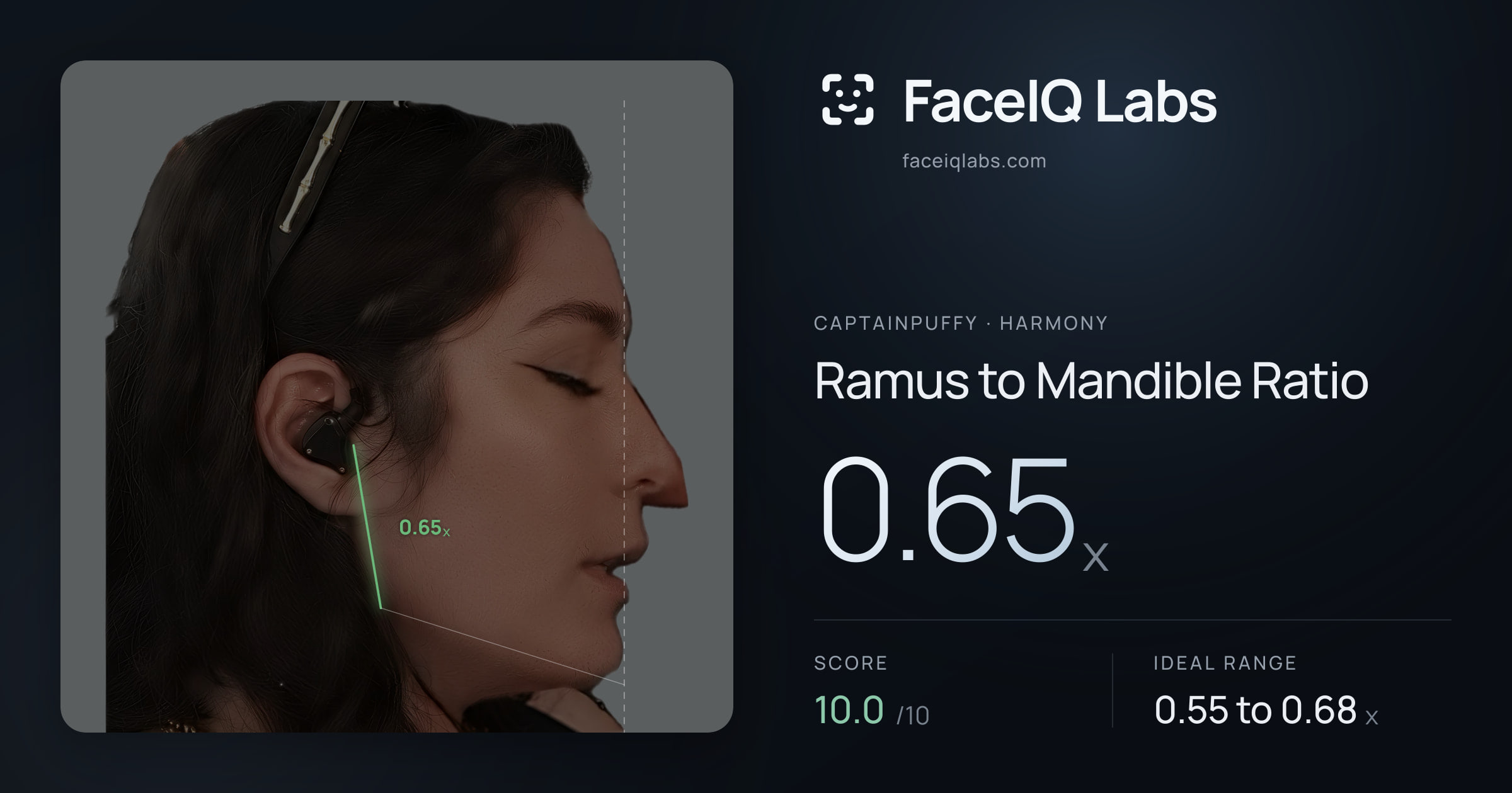 CaptainPuffy Ramus to Mandible Ratio: 0.65x, drawn on the photo