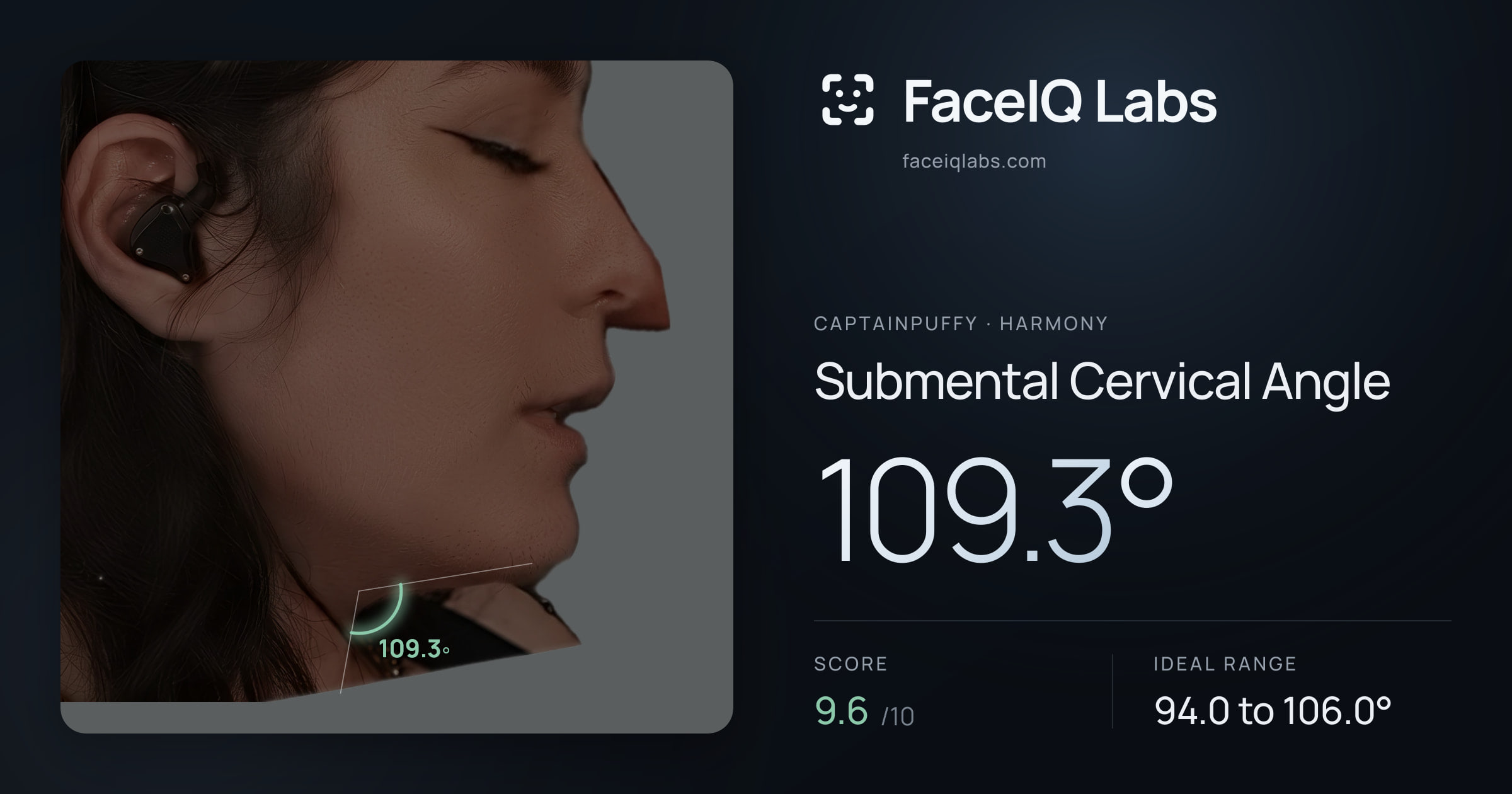 CaptainPuffy Submental Cervical Angle: 109.3°, drawn on the photo