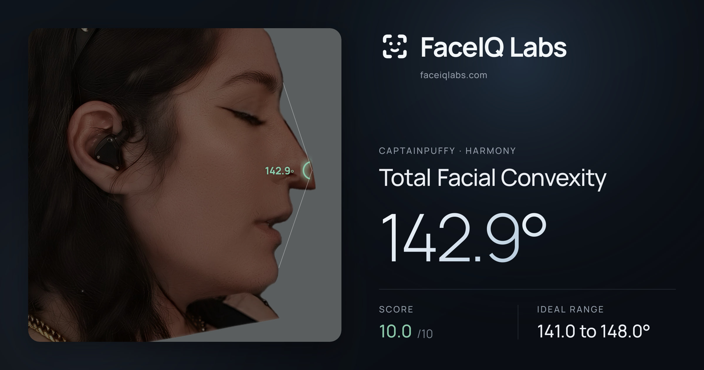 CaptainPuffy Total Facial Convexity: 142.9°, drawn on the photo