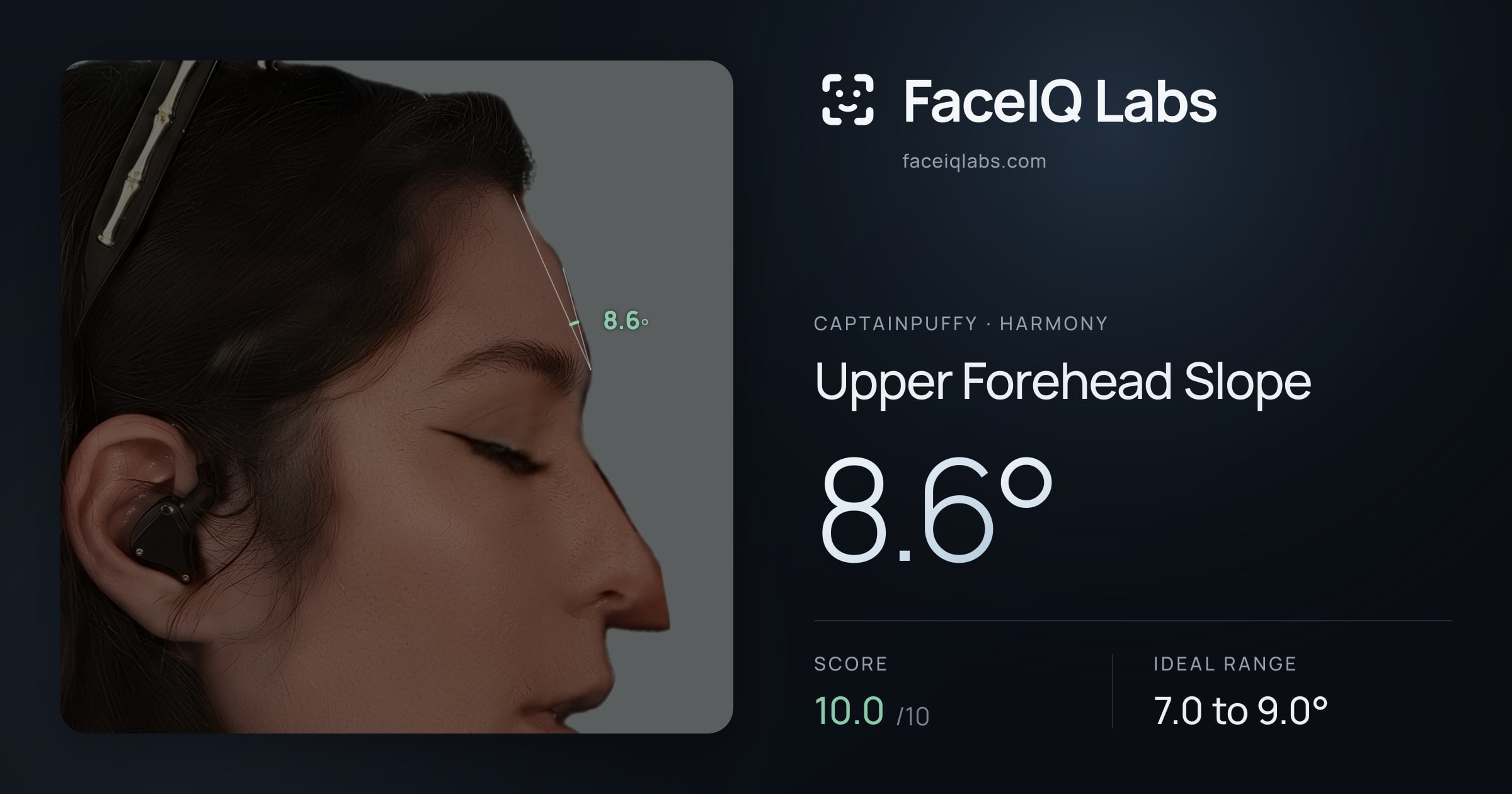 CaptainPuffy Upper Forehead Slope: 8.6°, drawn on the photo