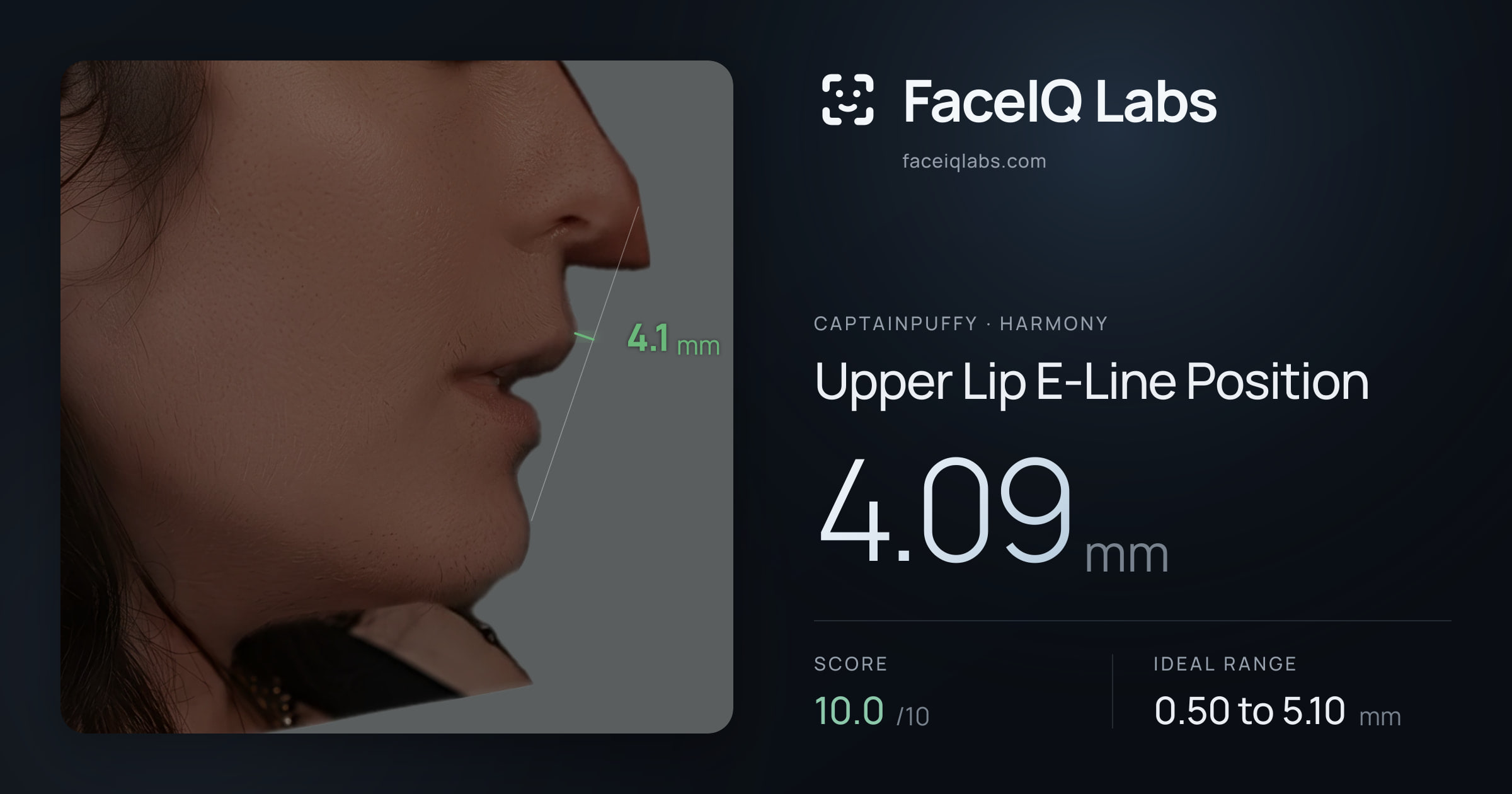 CaptainPuffy Upper Lip E-Line Position: 4.09mm, drawn on the photo