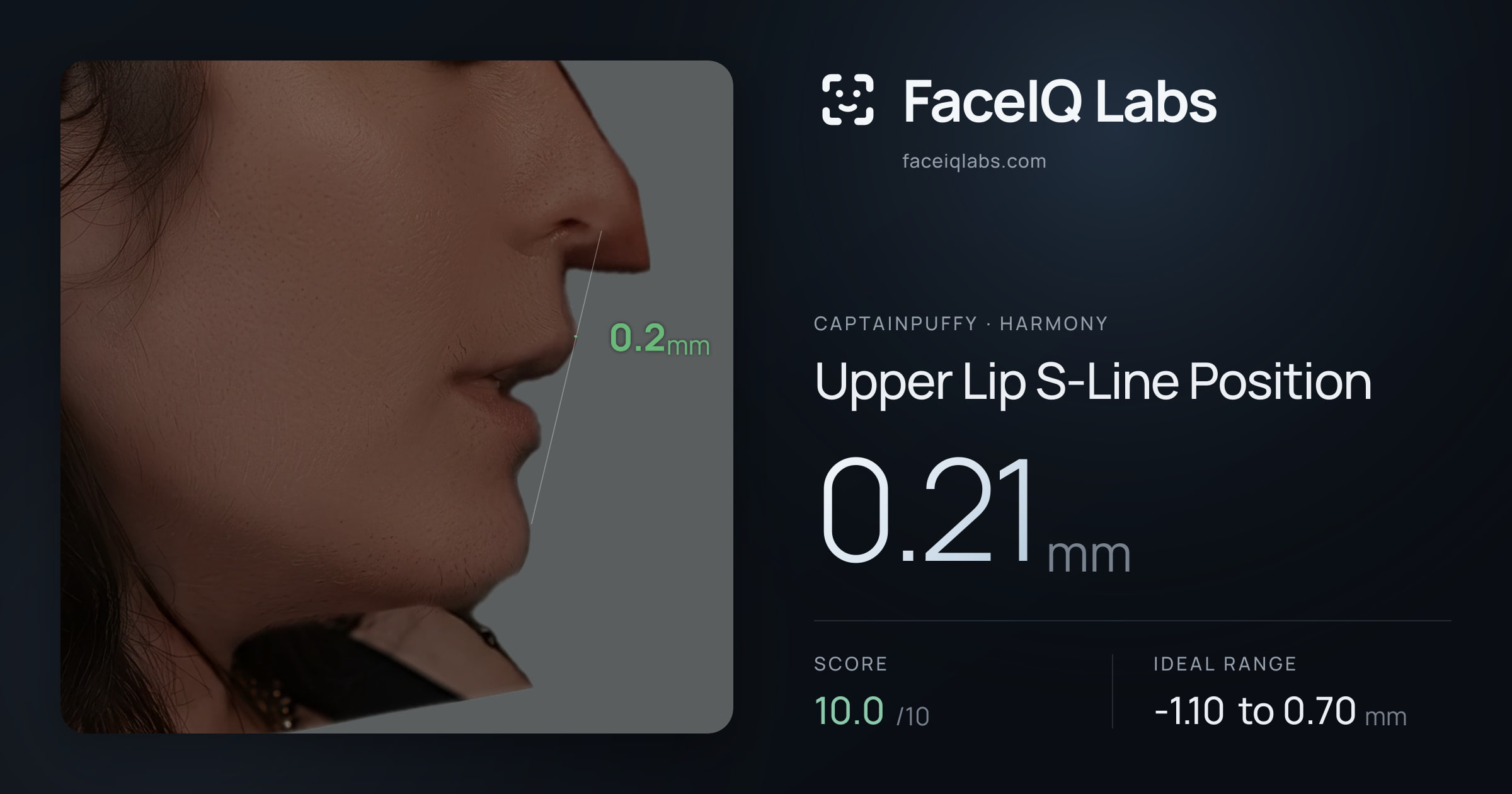 CaptainPuffy Upper Lip S-Line Position: 0.21mm, drawn on the photo