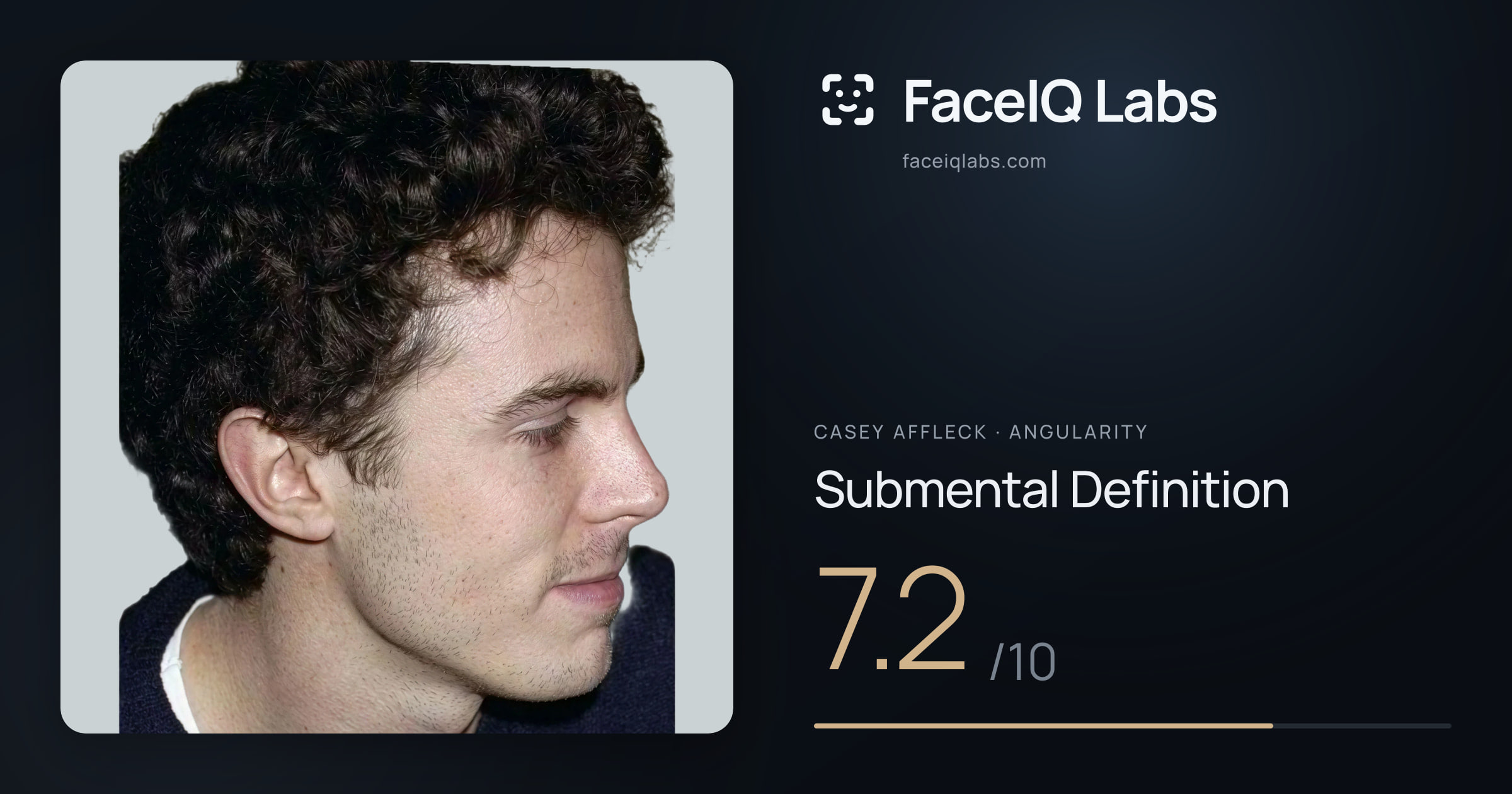 Casey Affleck Submental Definition: 7.2/10, drawn on the photo