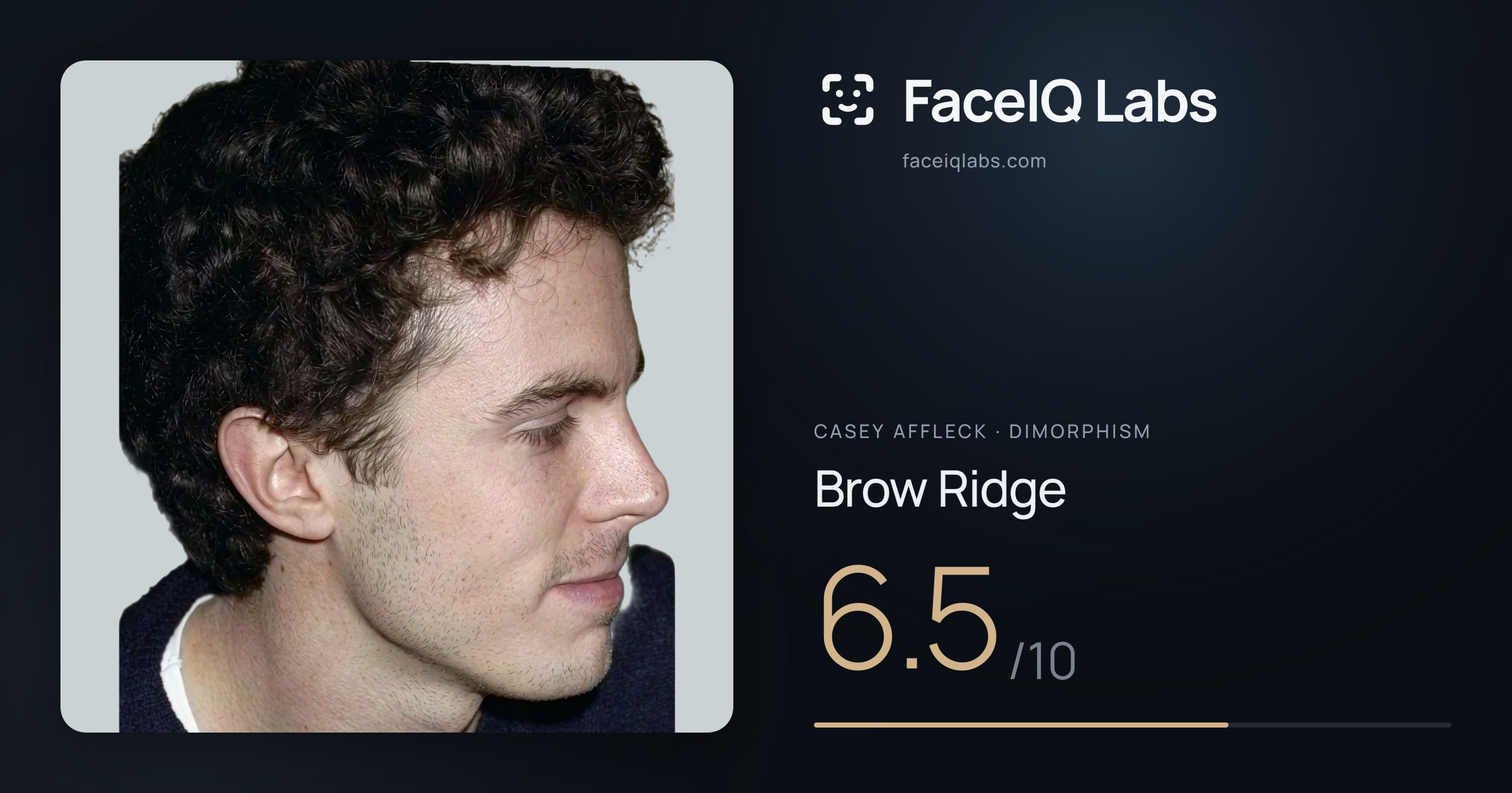 Casey Affleck Brow Ridge: 6.5/10, drawn on the photo
