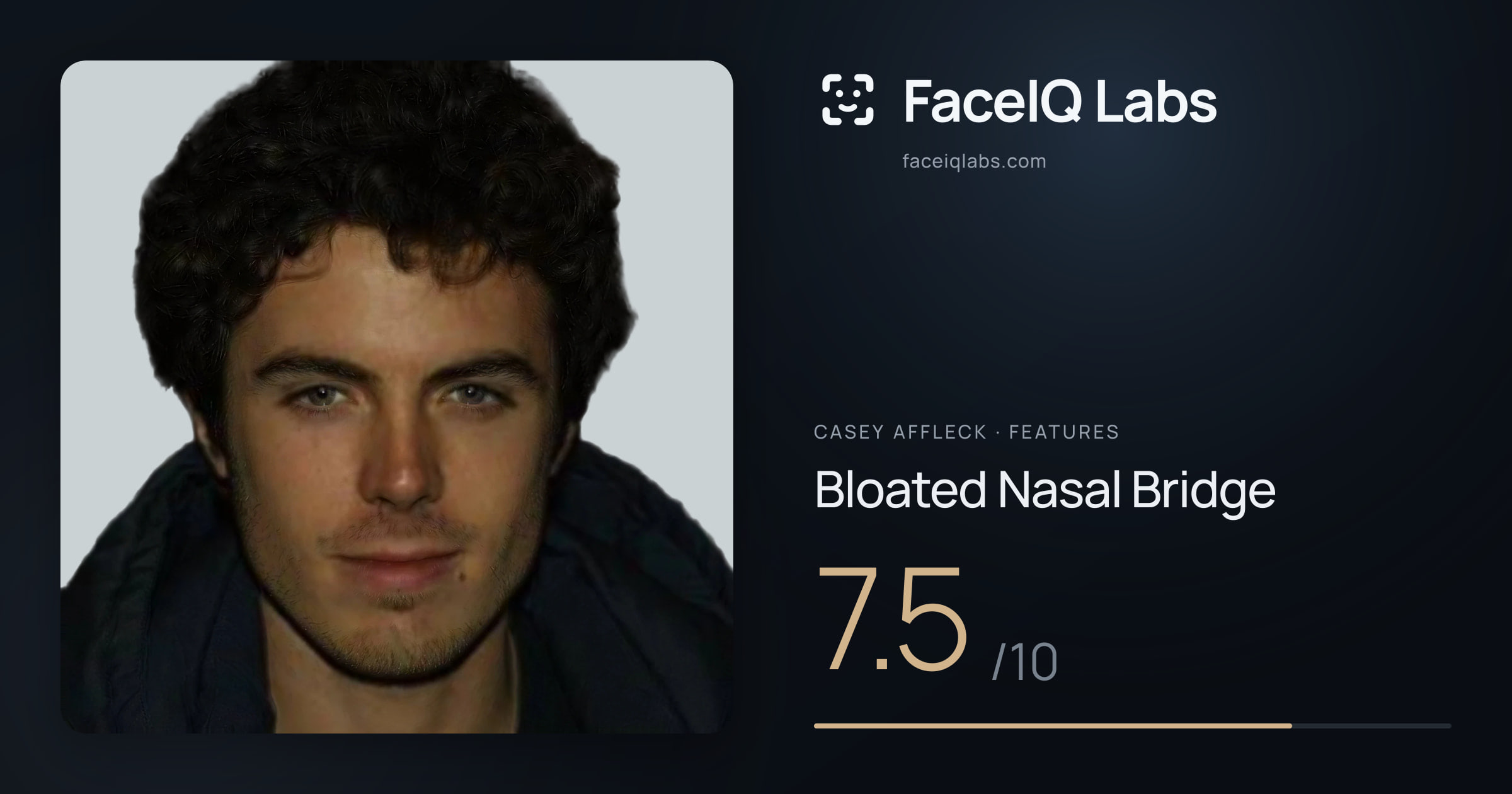 Casey Affleck Bloated Nasal Bridge: 7.5/10, drawn on the photo